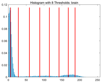 Symmetry 17 02120 i007
