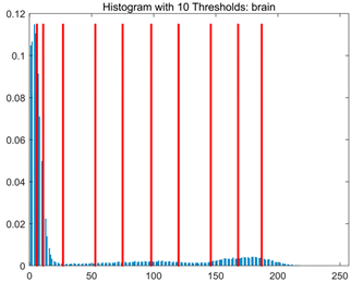 Symmetry 17 02120 i008