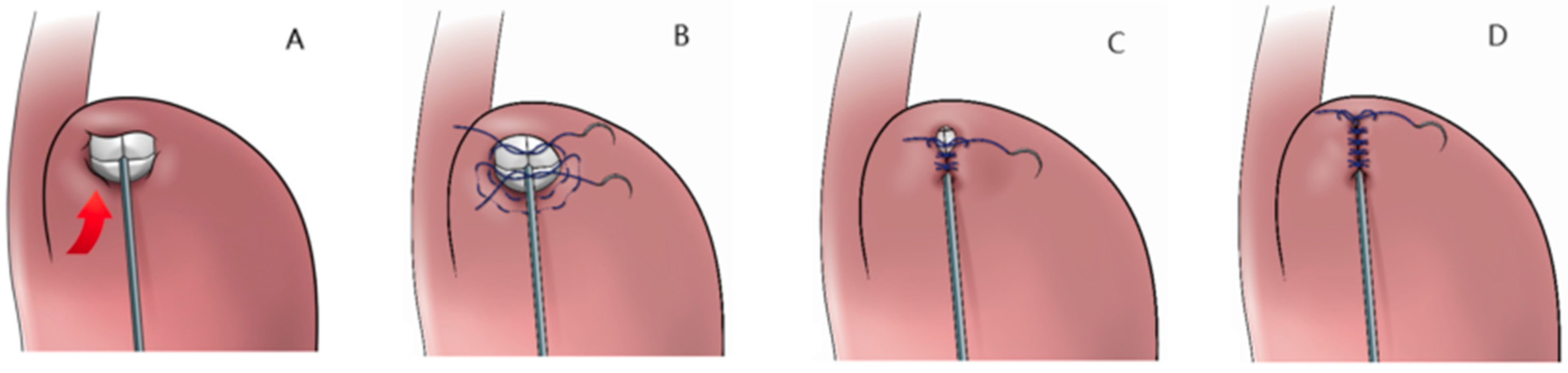Therapeutics 02 00012 g004