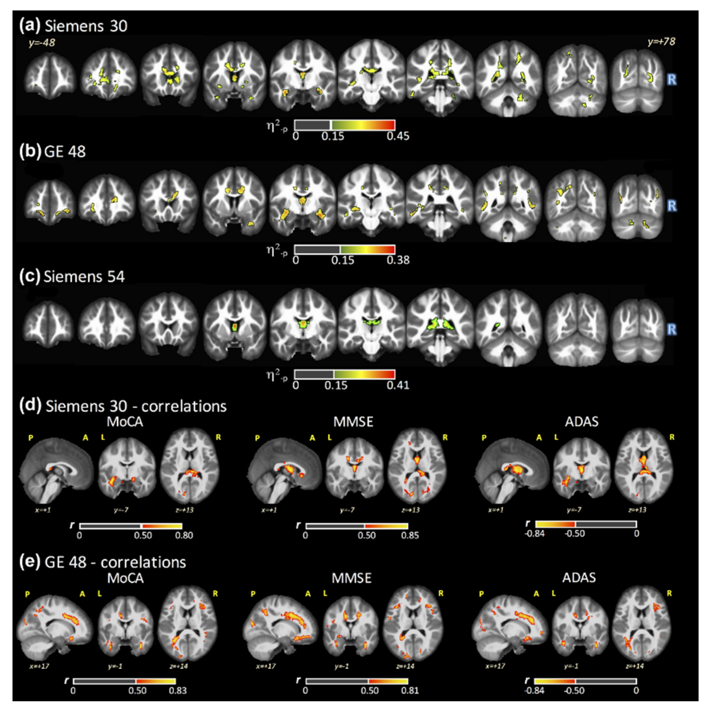 Tomography 07 00003 g001 Tomography 07 00003 g001