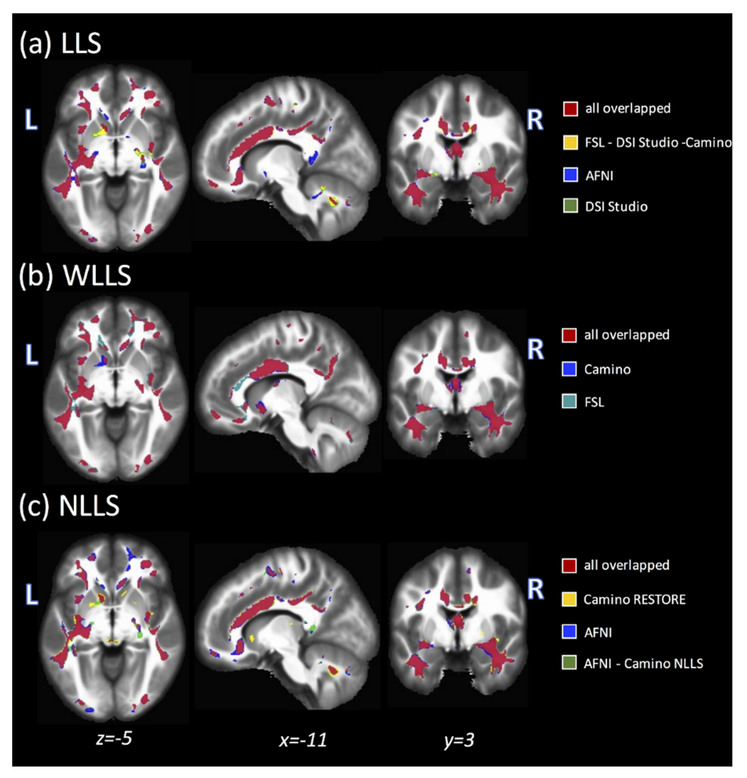 Tomography 07 00003 g003 Tomography 07 00003 g003