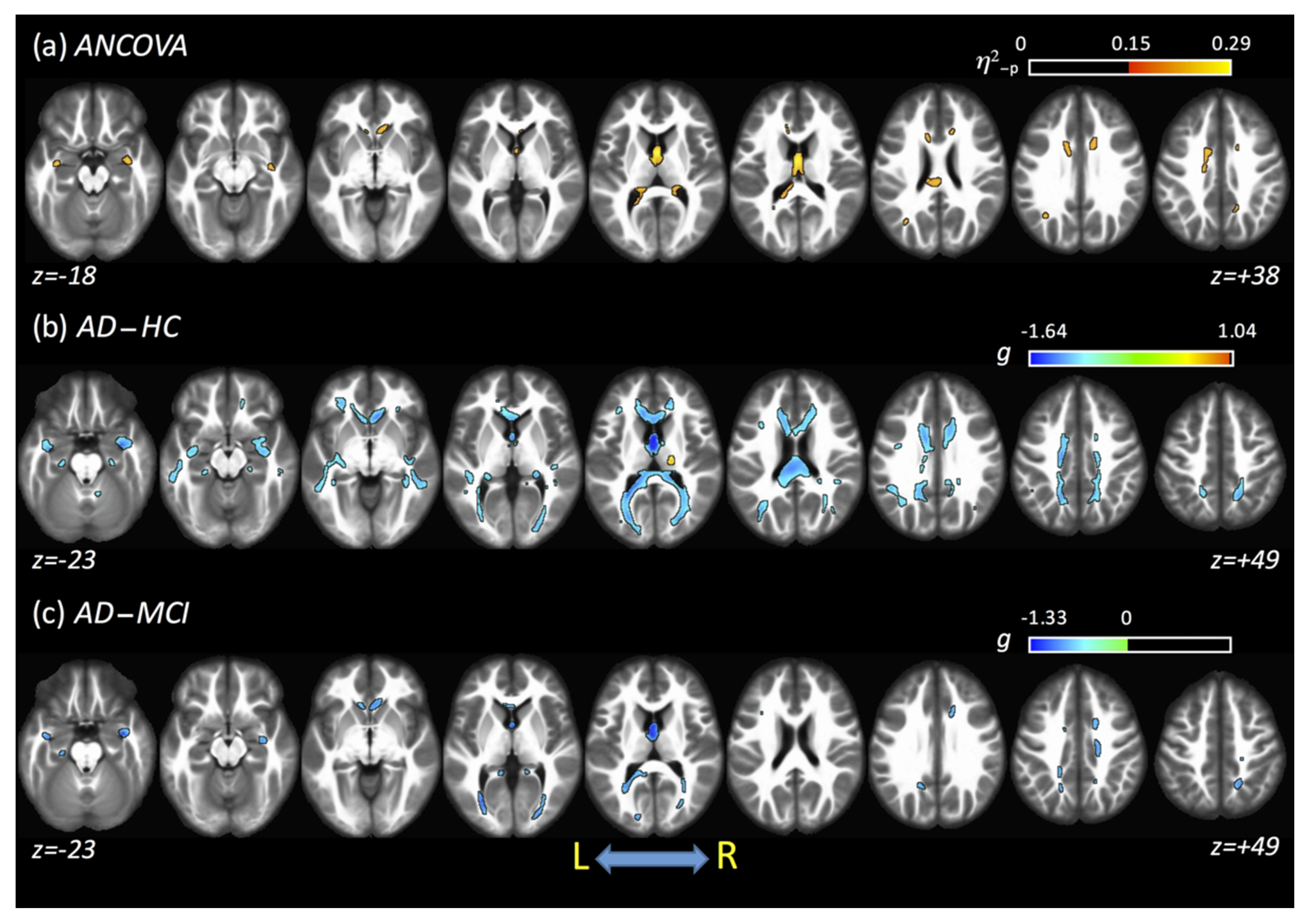 Tomography 07 00003 g005 Tomography 07 00003 g005