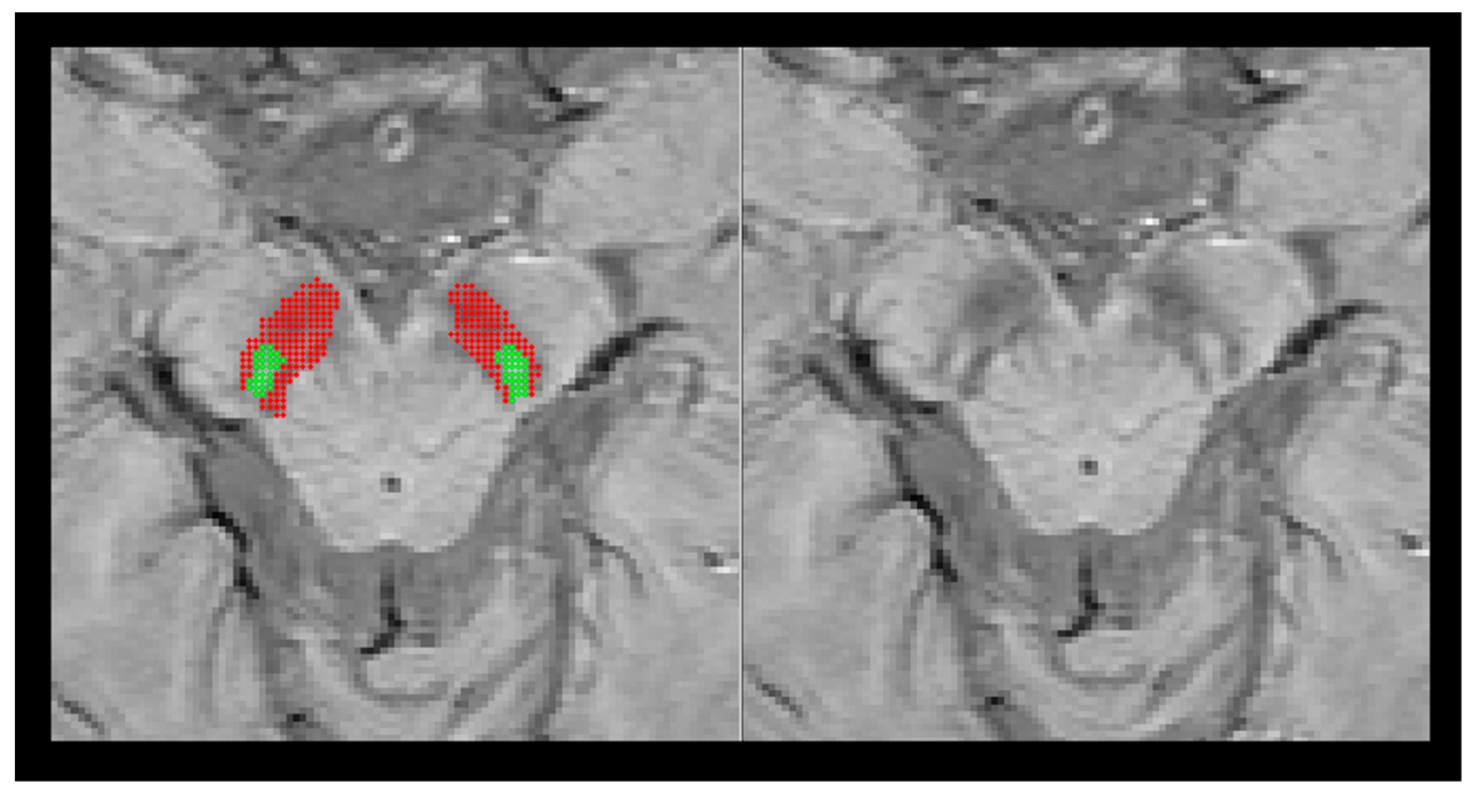 Tomography 07 00010 g001