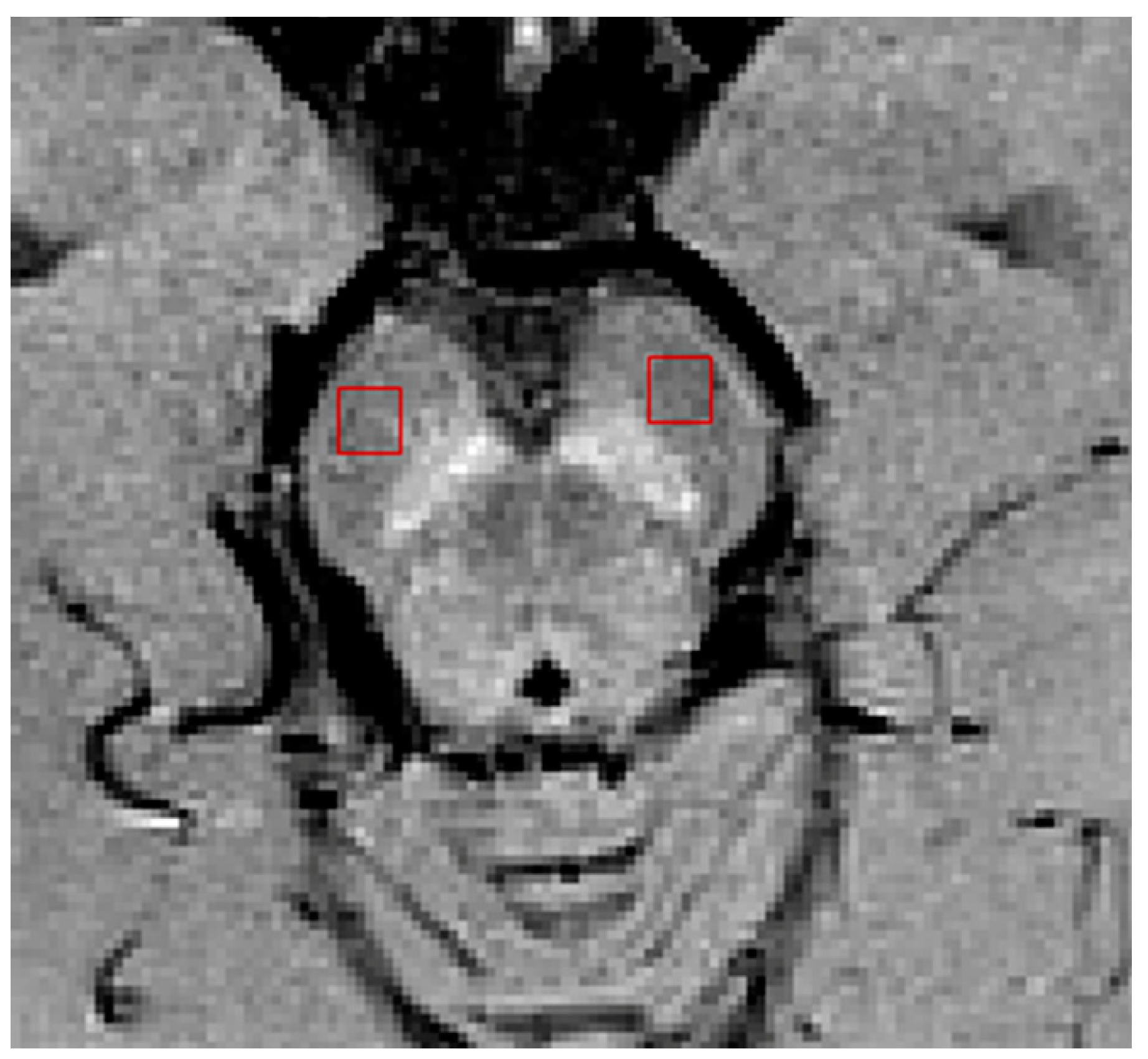 Tomography 07 00010 g002