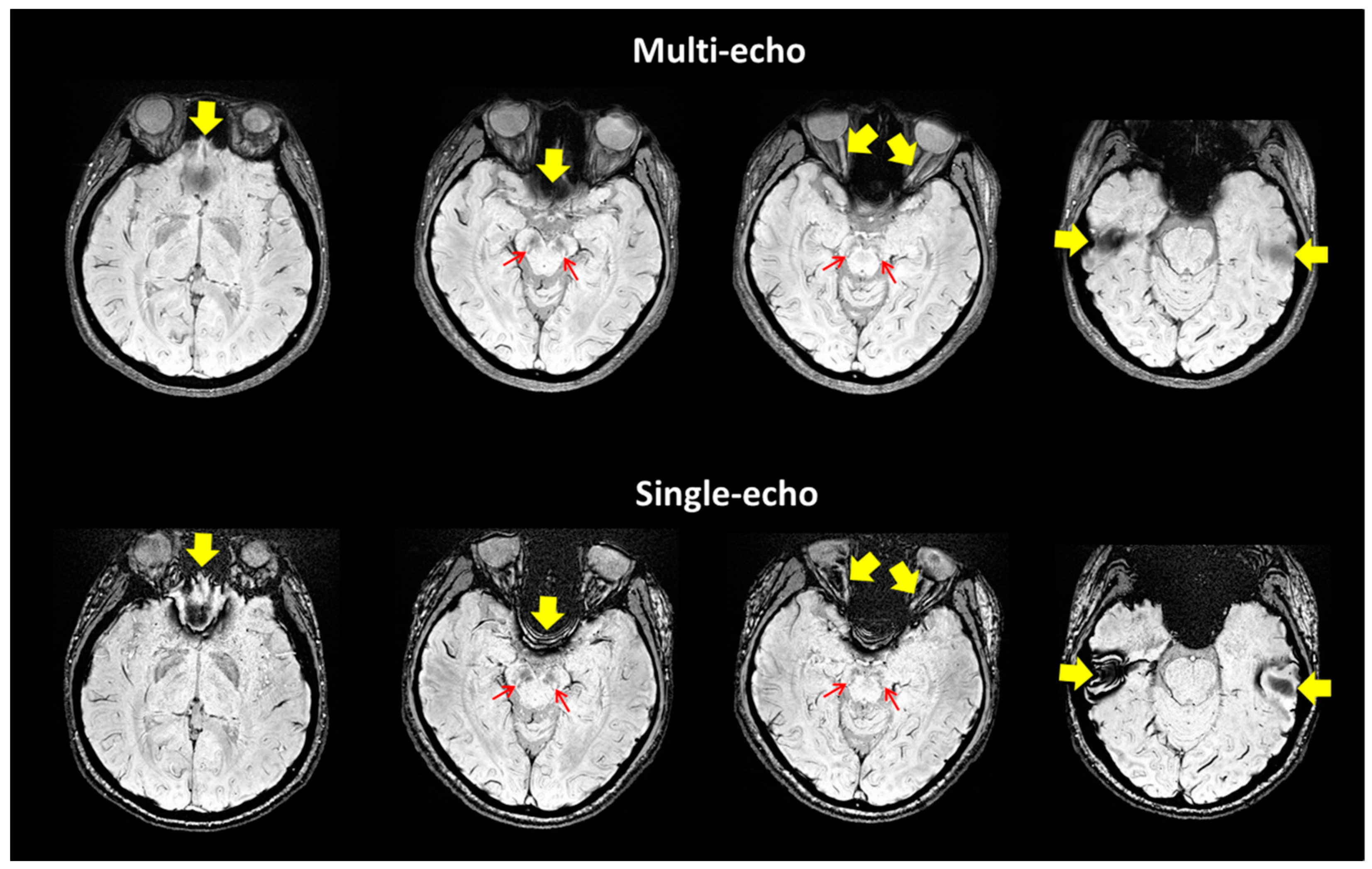 Tomography 07 00010 g003
