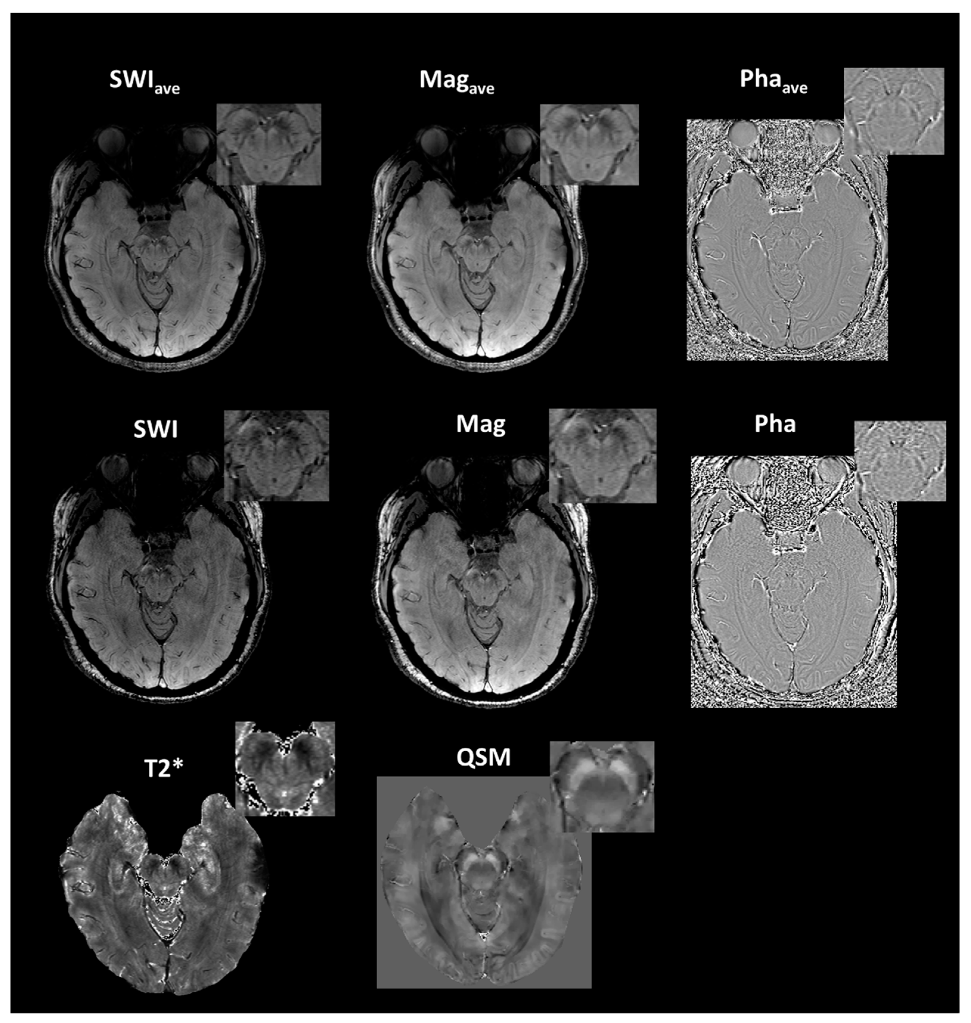 Tomography 07 00010 g004