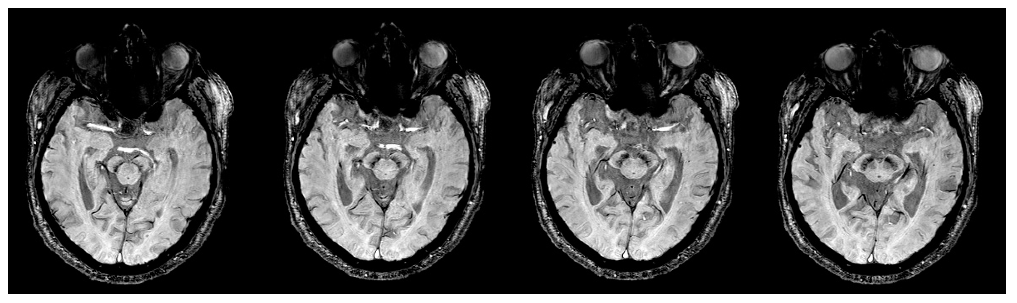 Tomography 07 00010 g006