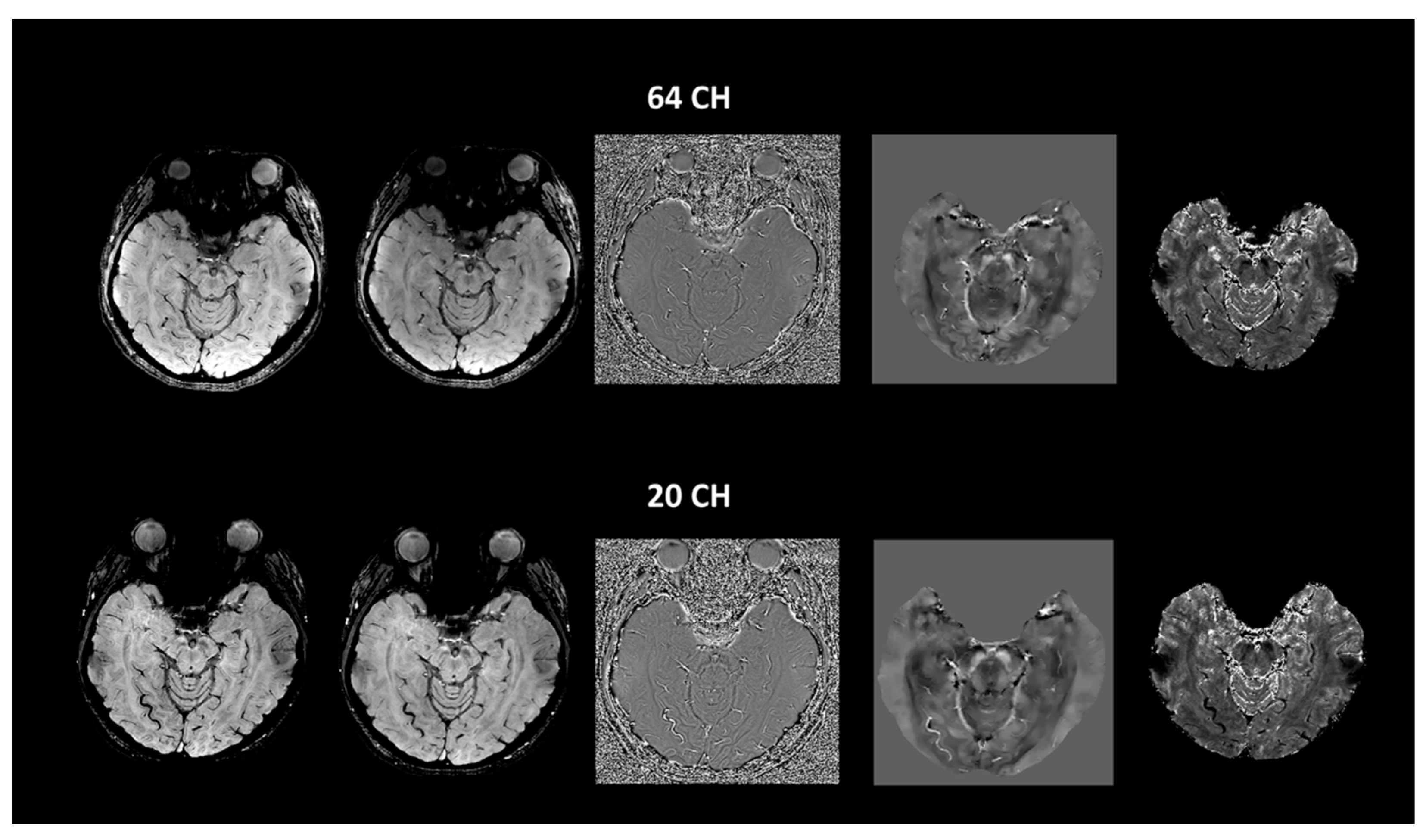 Tomography 07 00010 g007