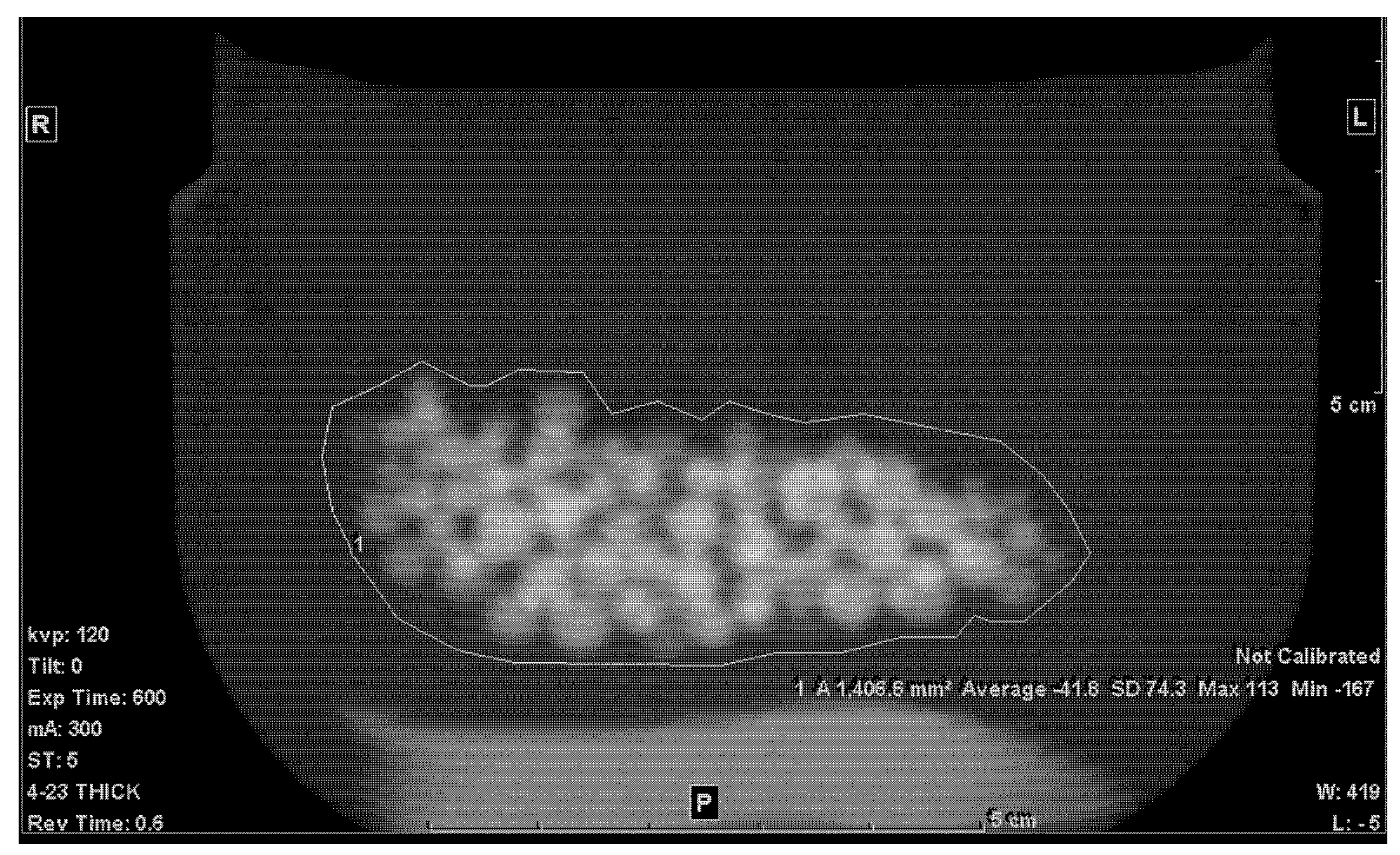 Tomography 07 00011 g002