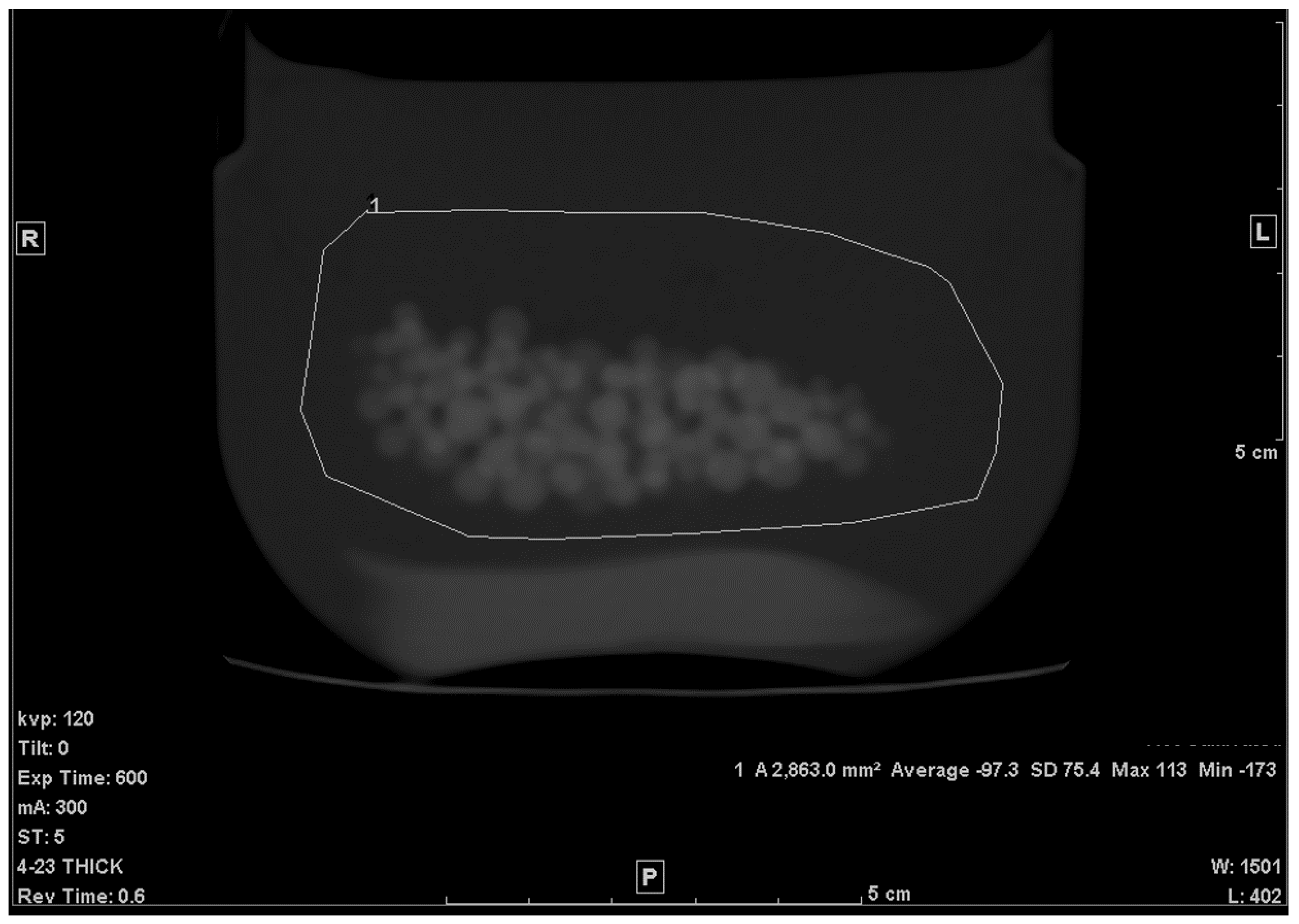 Tomography 07 00011 g003