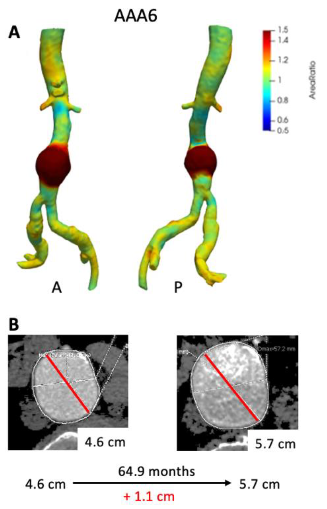 Tomography 07 00017 g005
