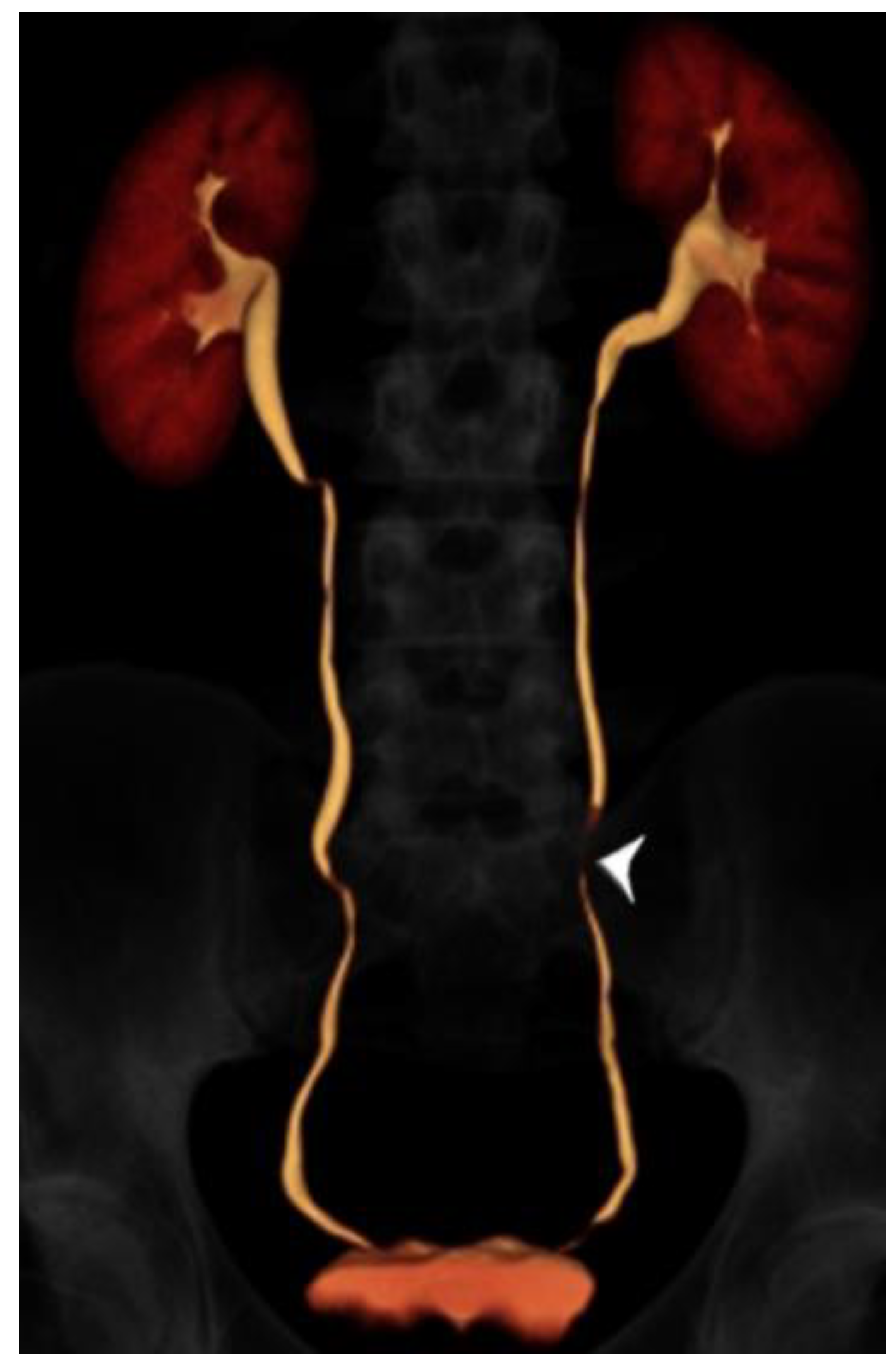 Tomography 07 00019 g002