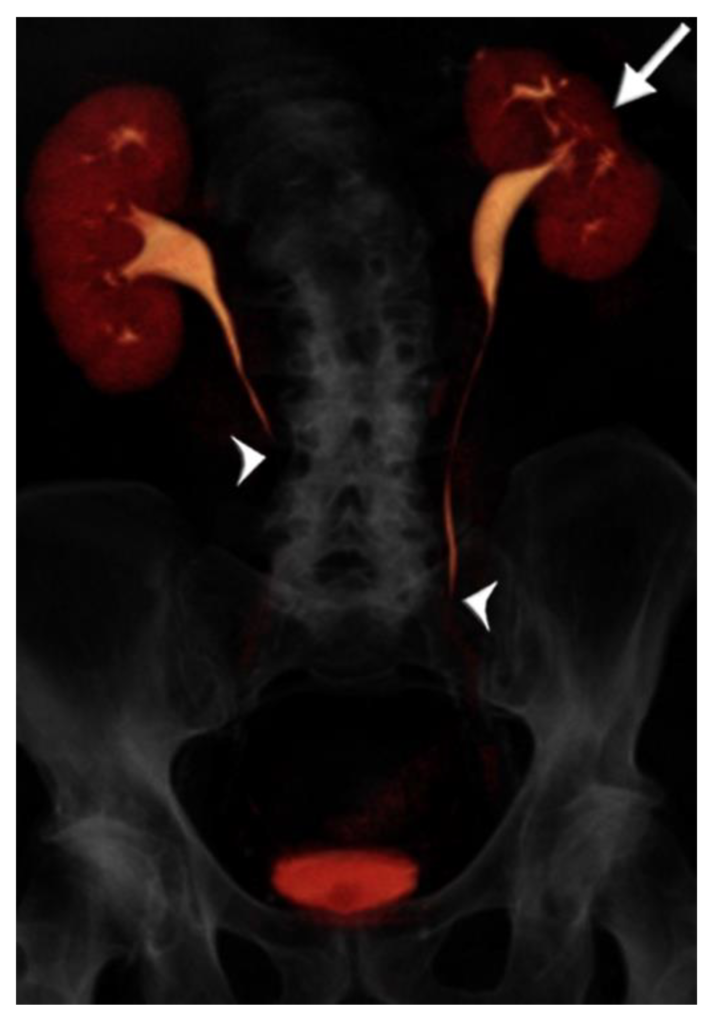 Tomography 07 00019 g003