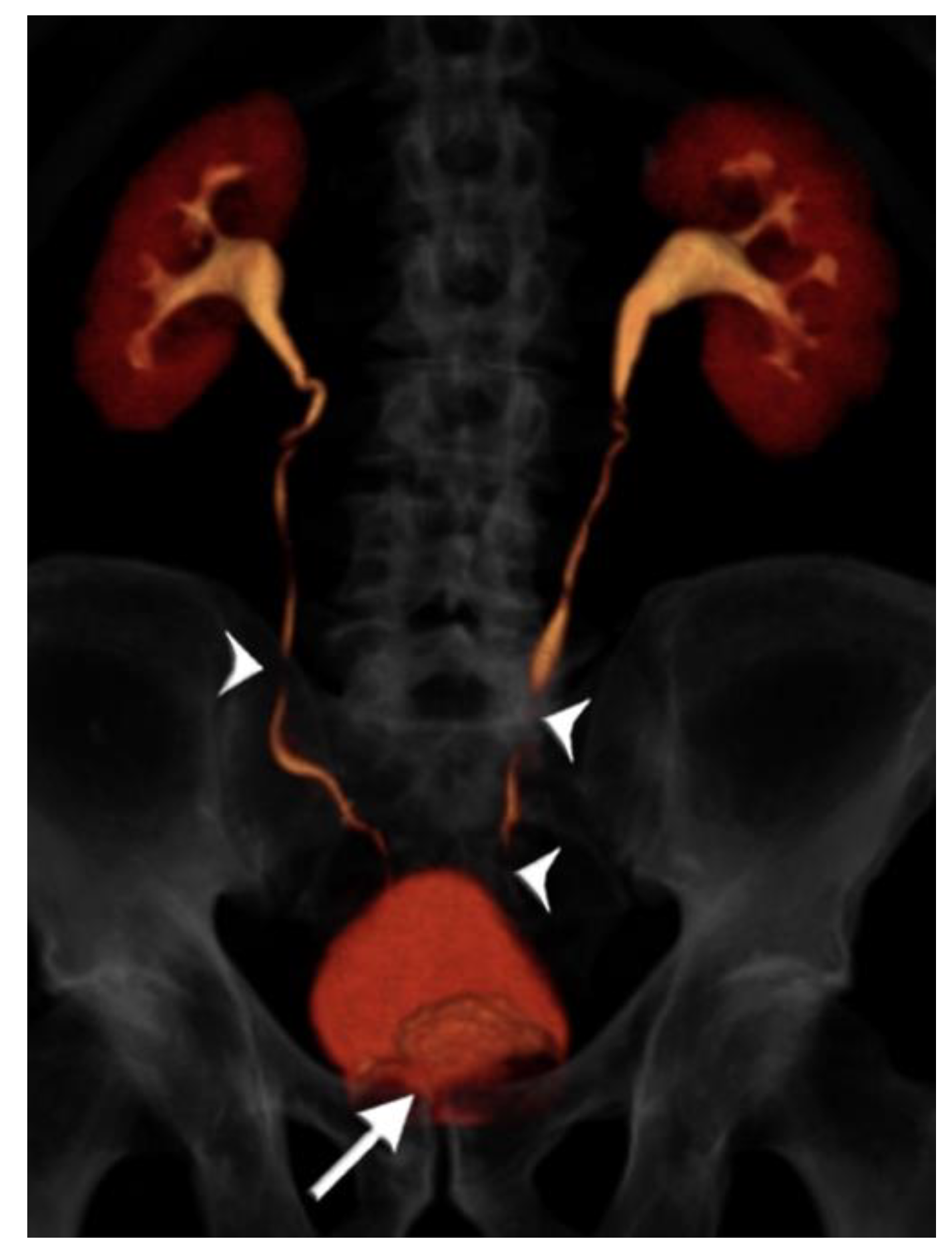 Tomography 07 00019 g004