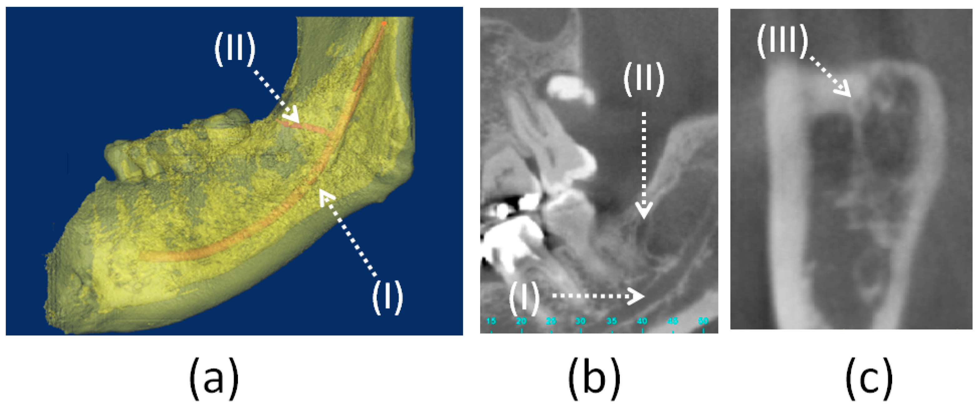 Tomography 07 00020 g001