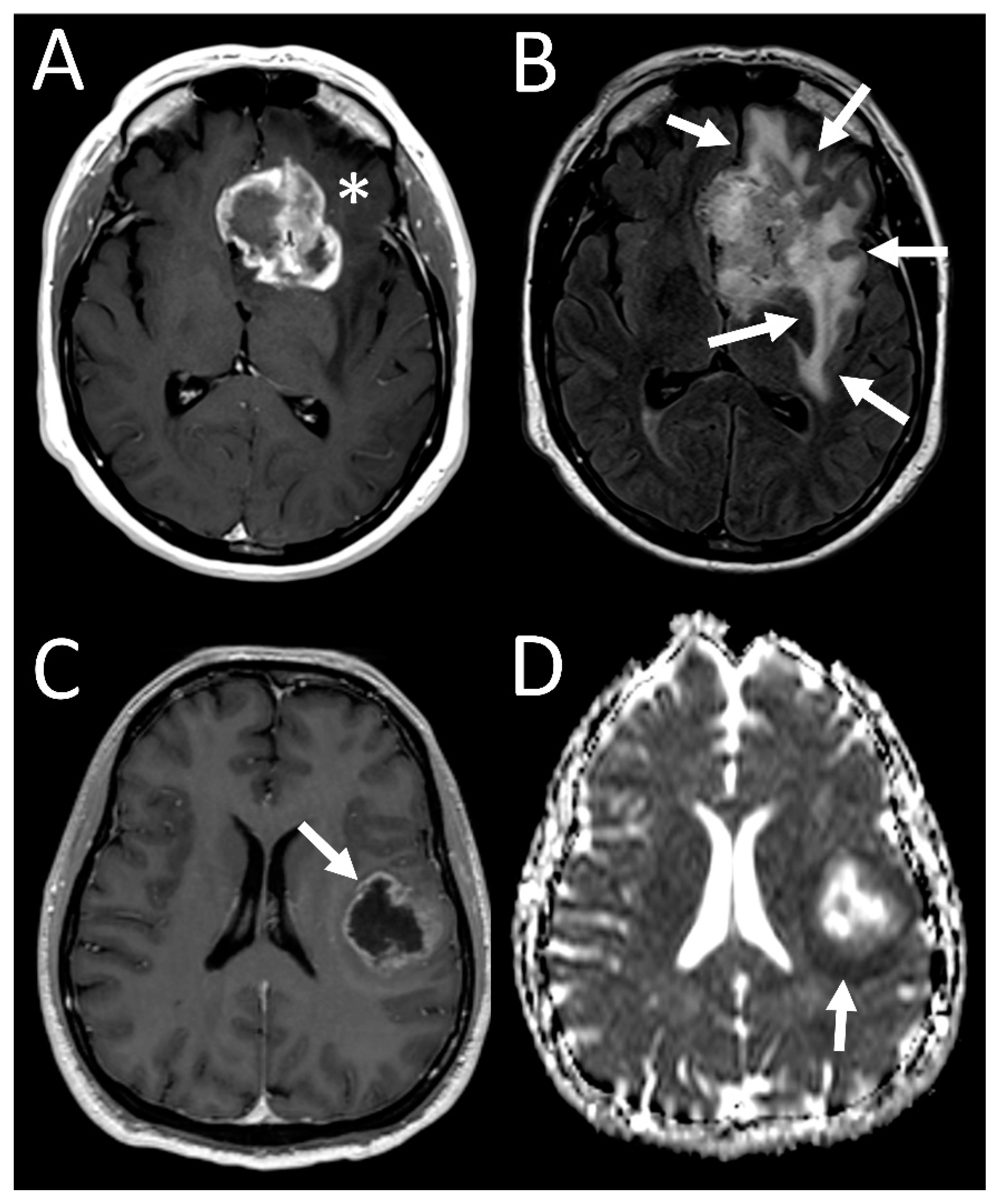 Tomography 07 00021 g001
