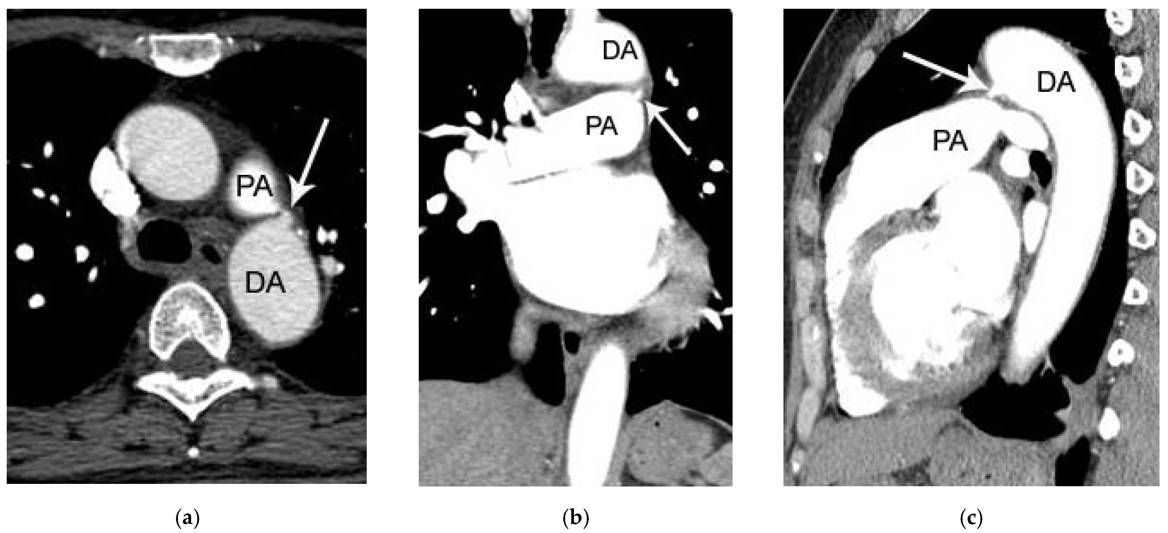 Tomography 07 00025 g003