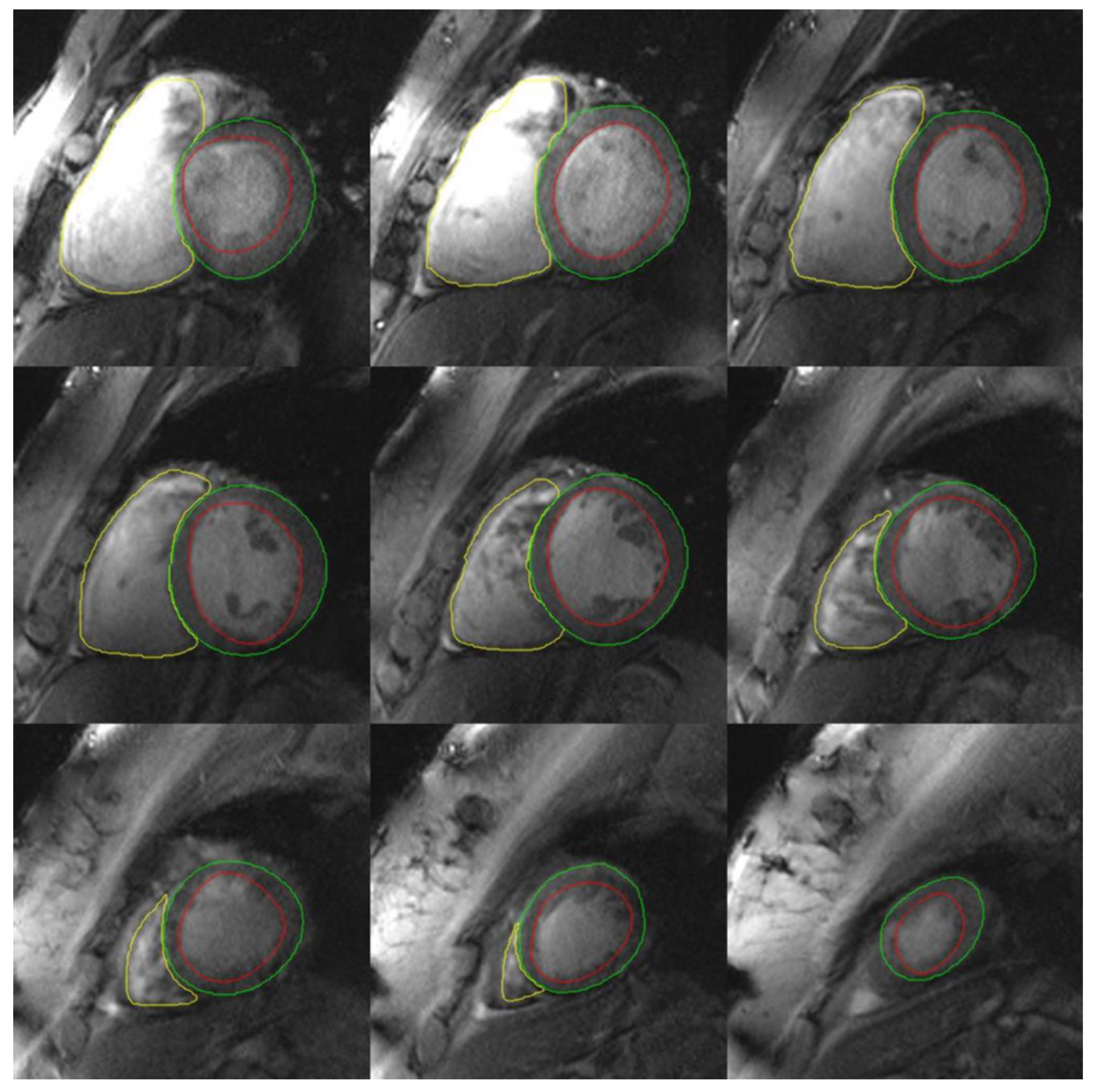 Tomography 07 00029 g004