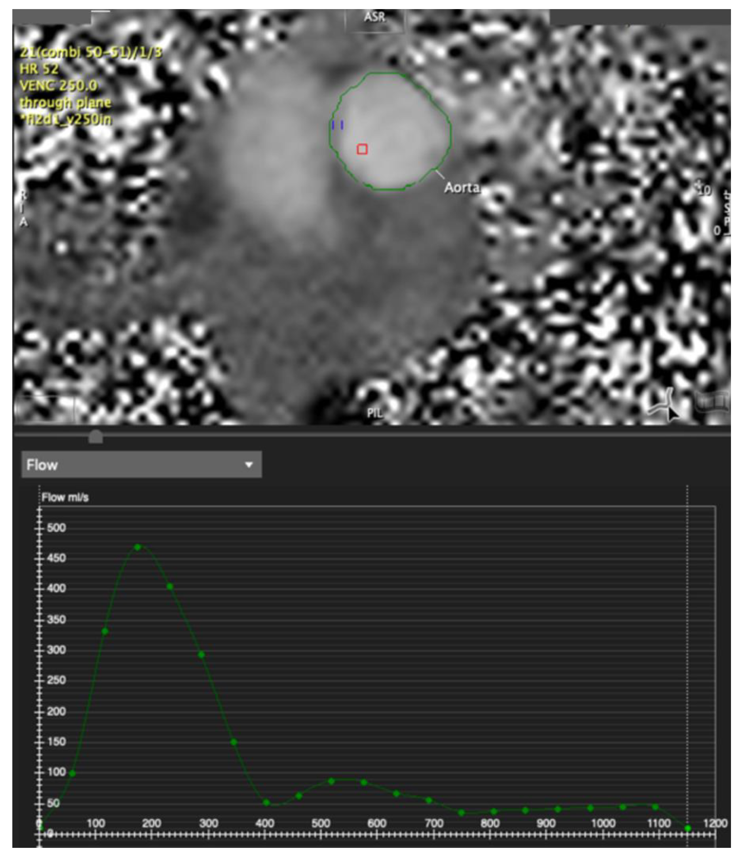 Tomography 07 00029 g005