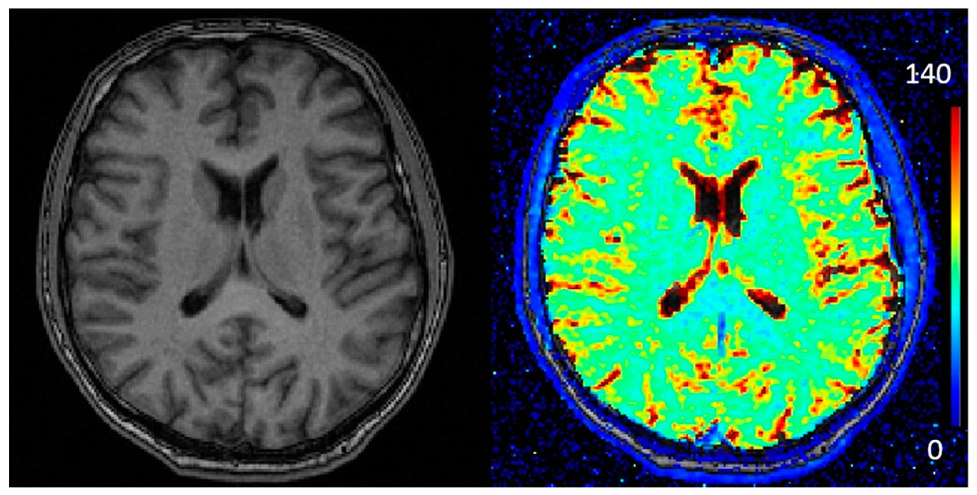 Tomography 07 00030 g002
