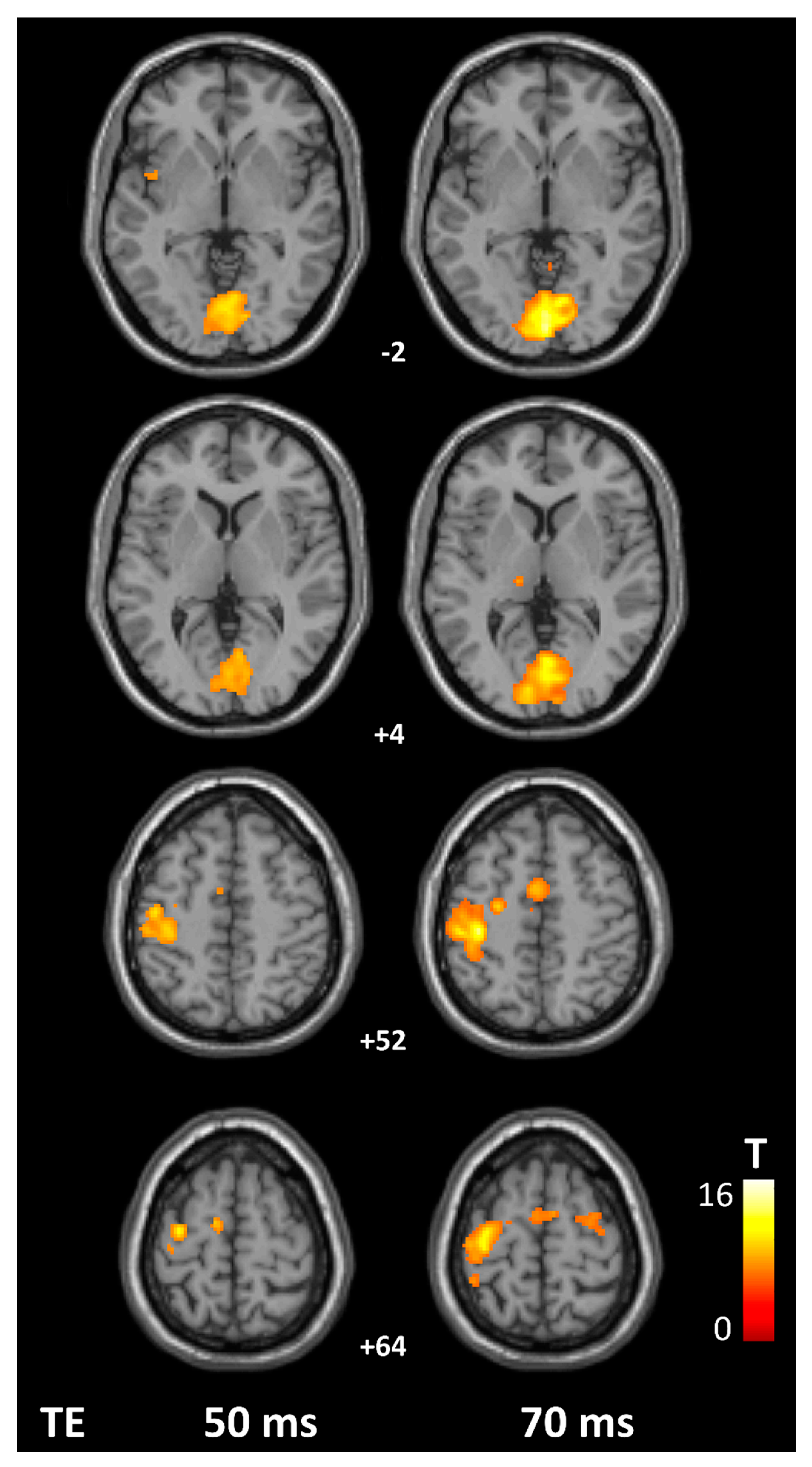 Tomography 07 00030 g003