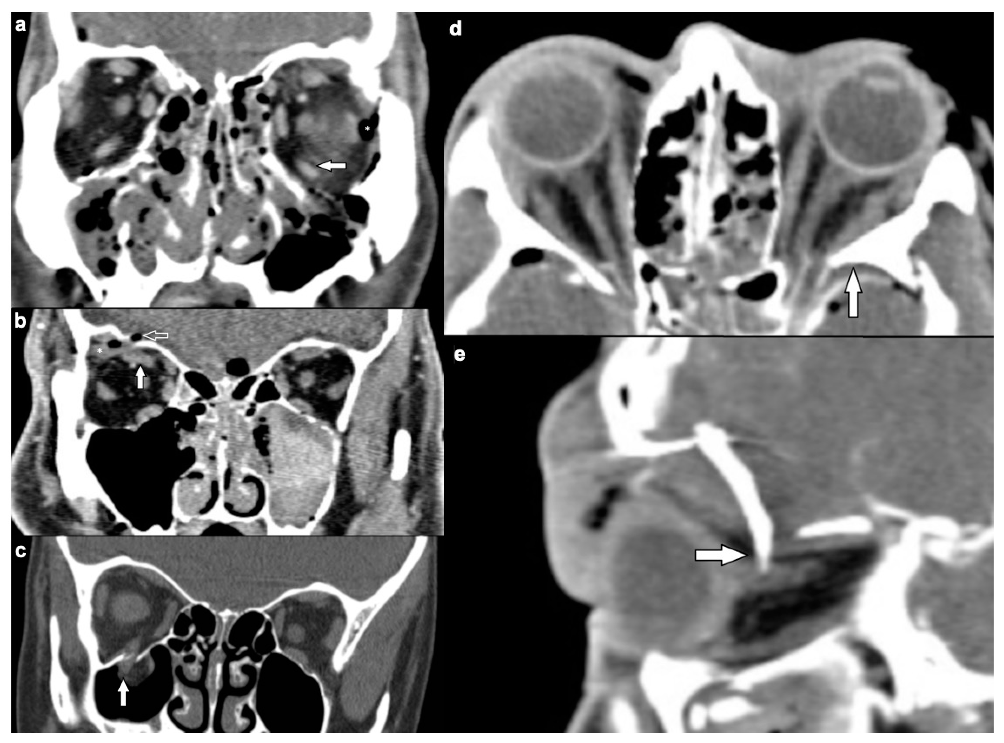 Tomography 07 00033 g002