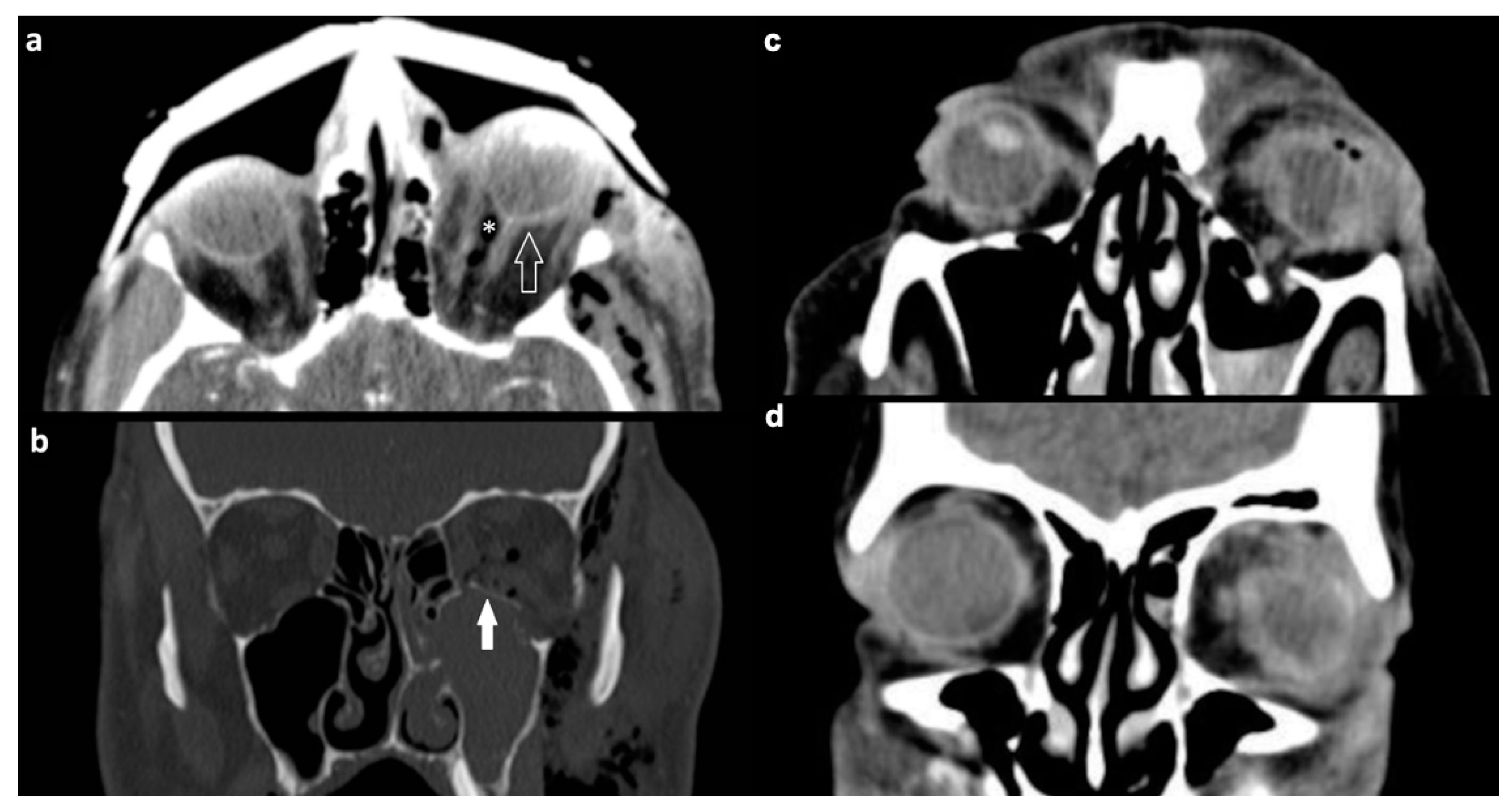 Tomography 07 00033 g003