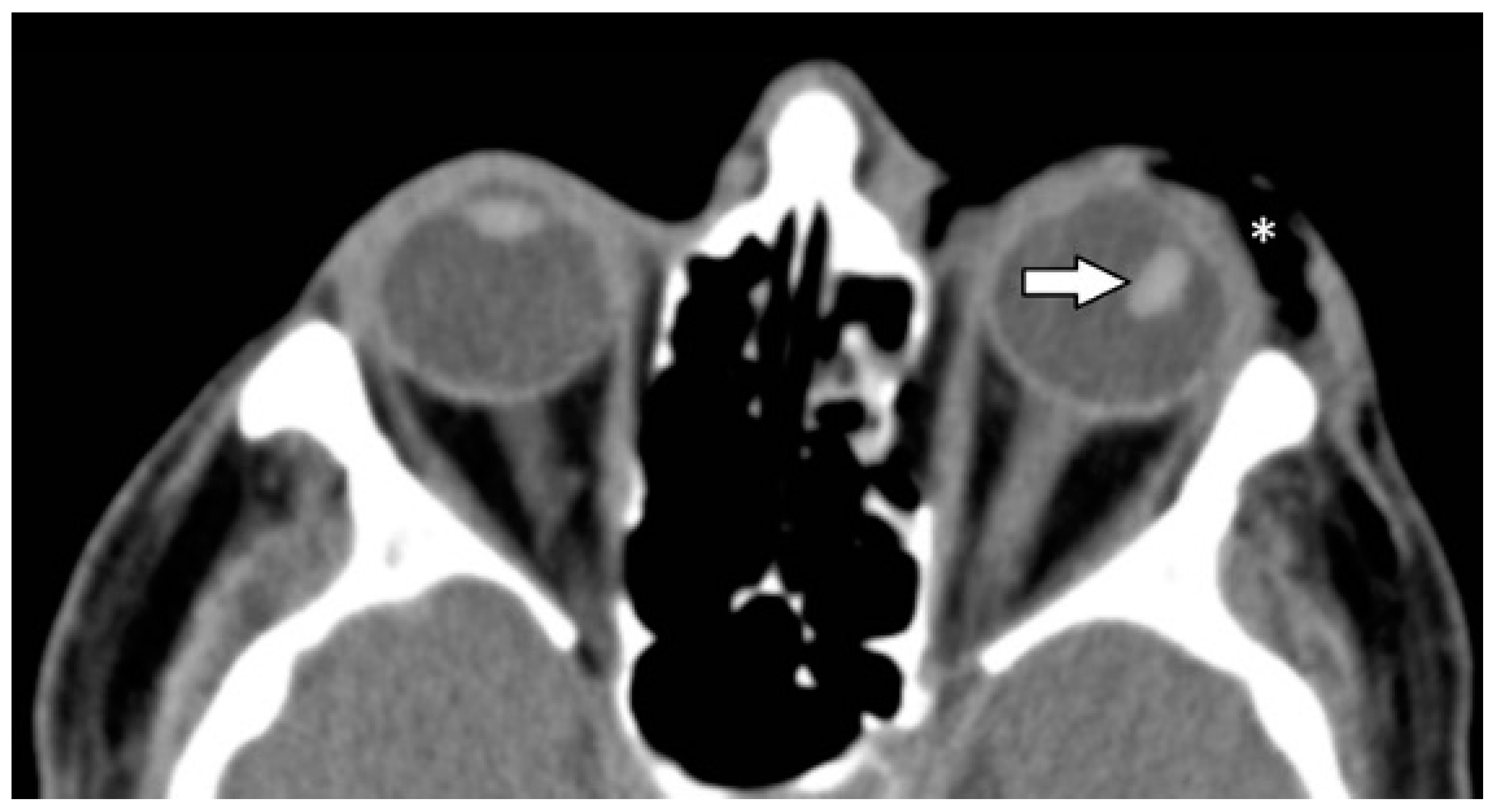 Tomography 07 00033 g004