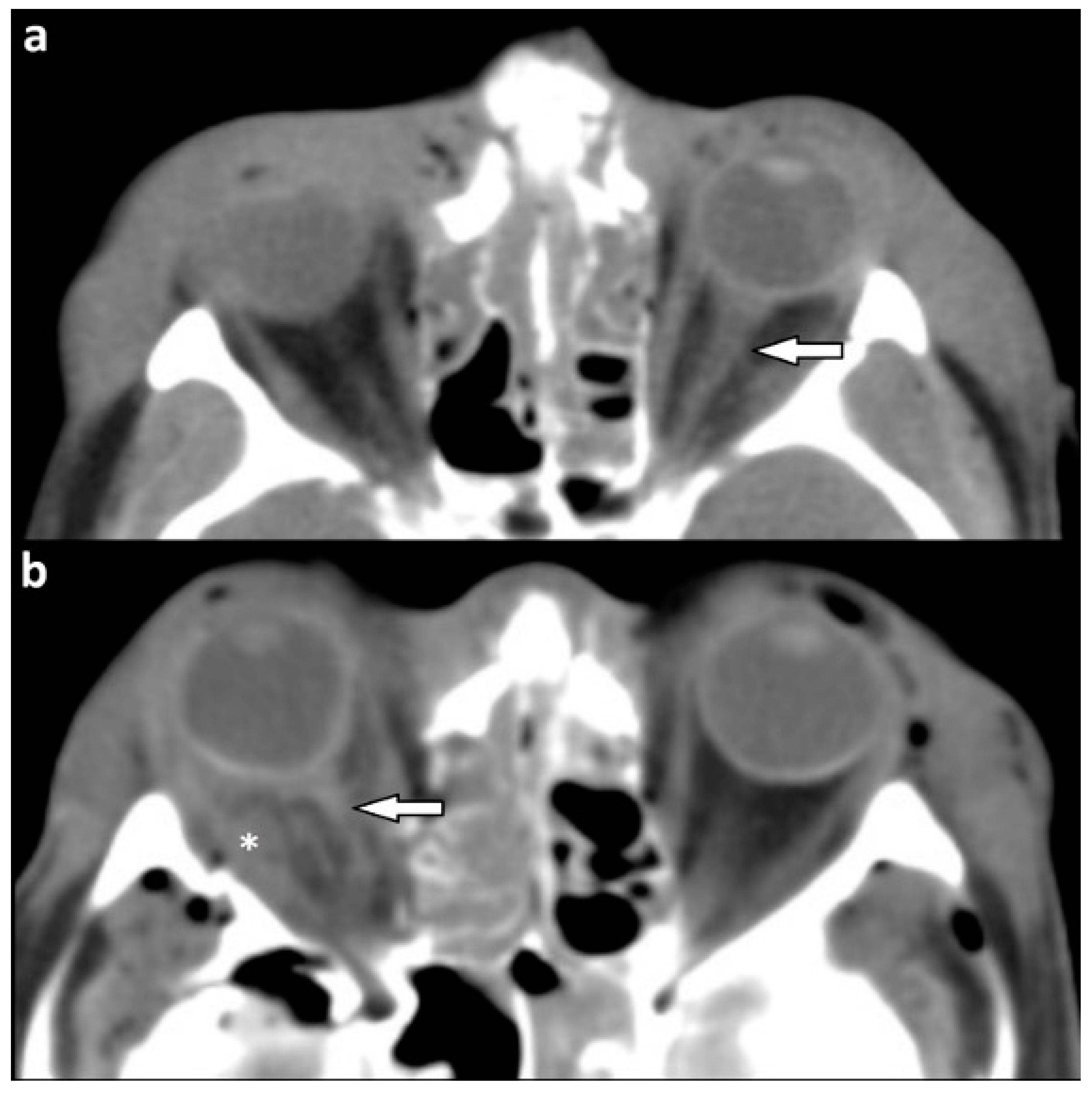 Tomography 07 00033 g005