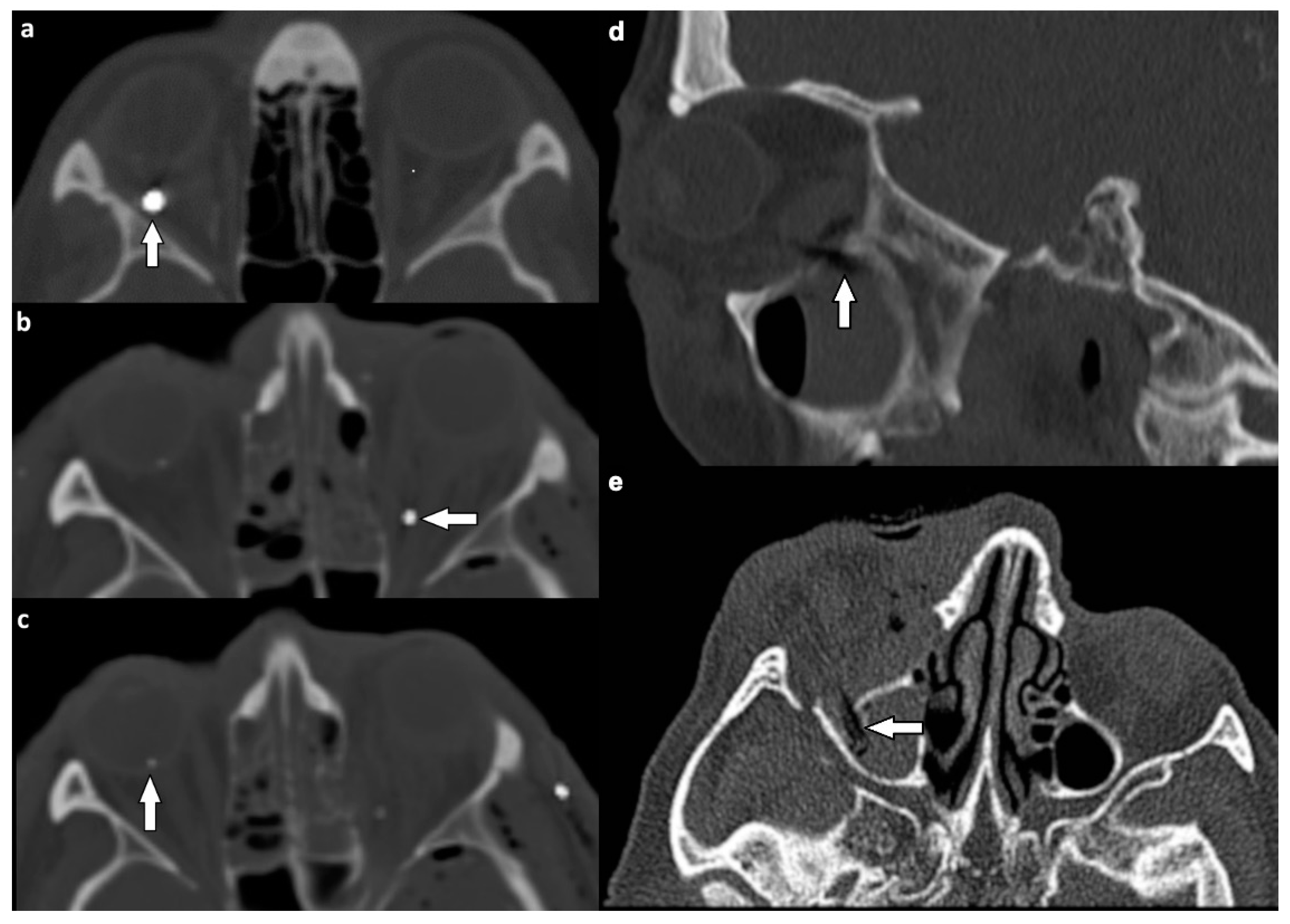 Tomography 07 00033 g007