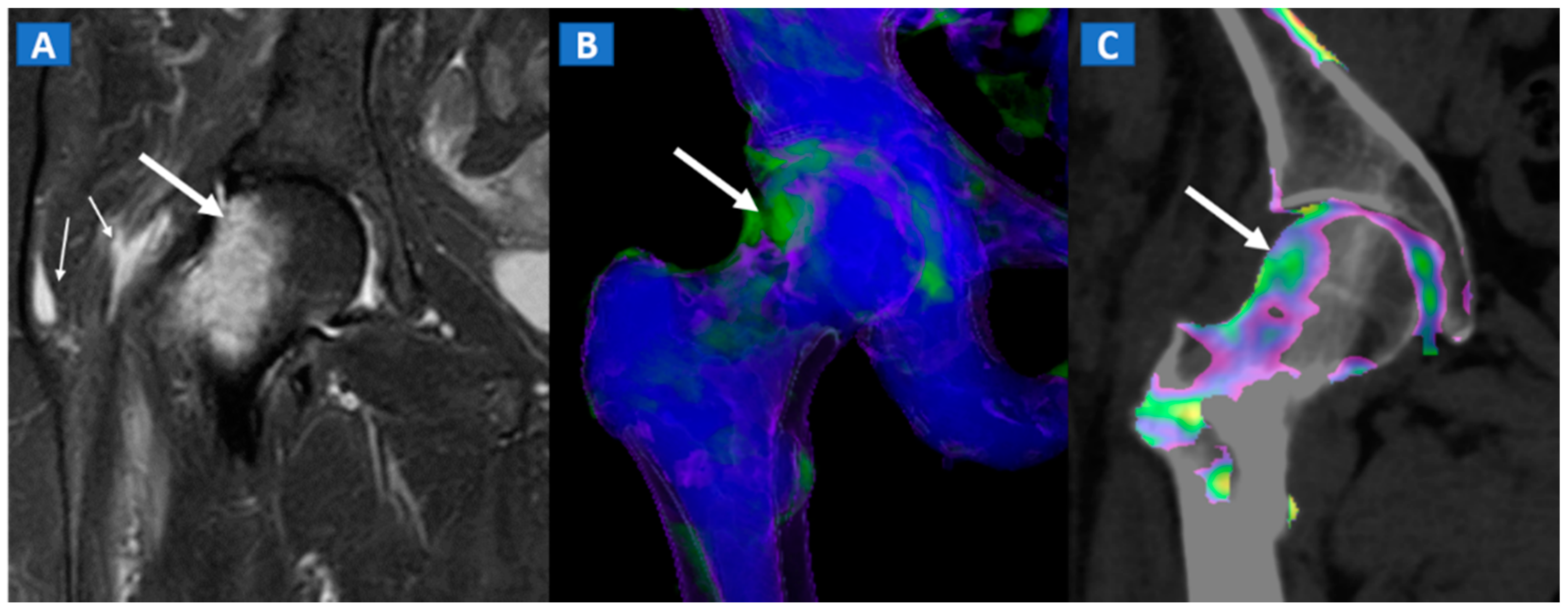 Tomography 07 00034 g006