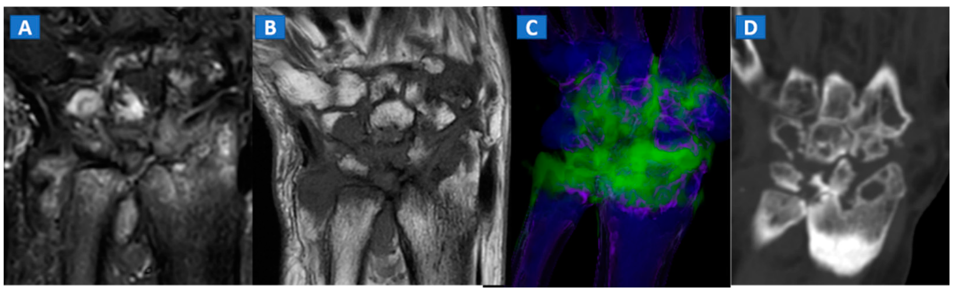 Tomography 07 00034 g008