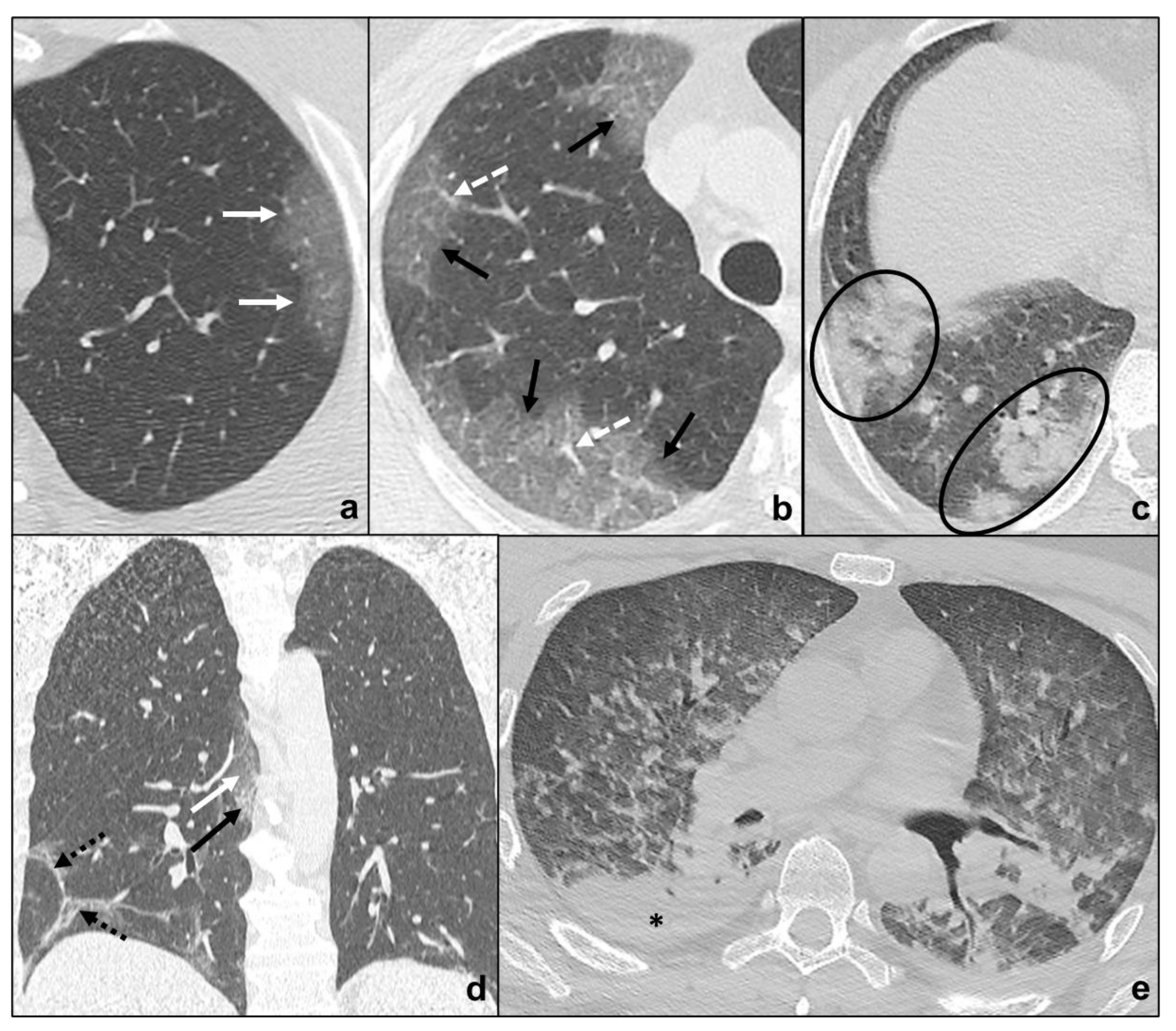 Tomography 07 00035 g001