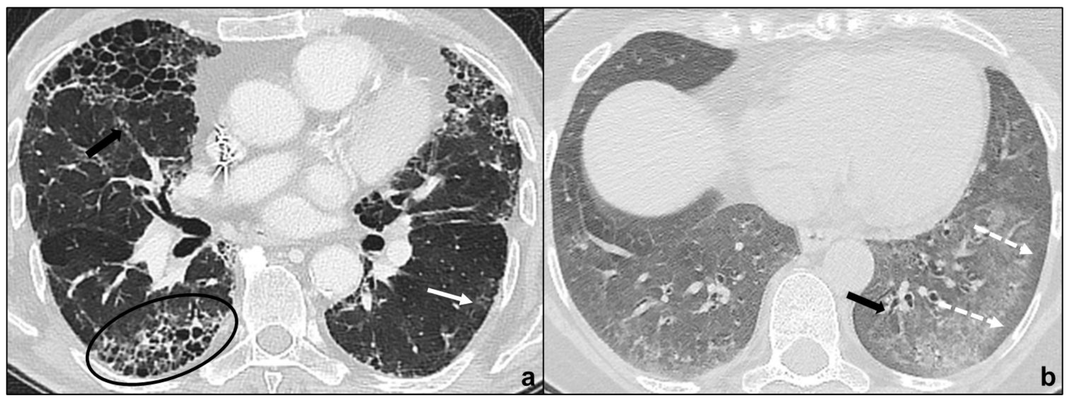 Tomography 07 00035 g003