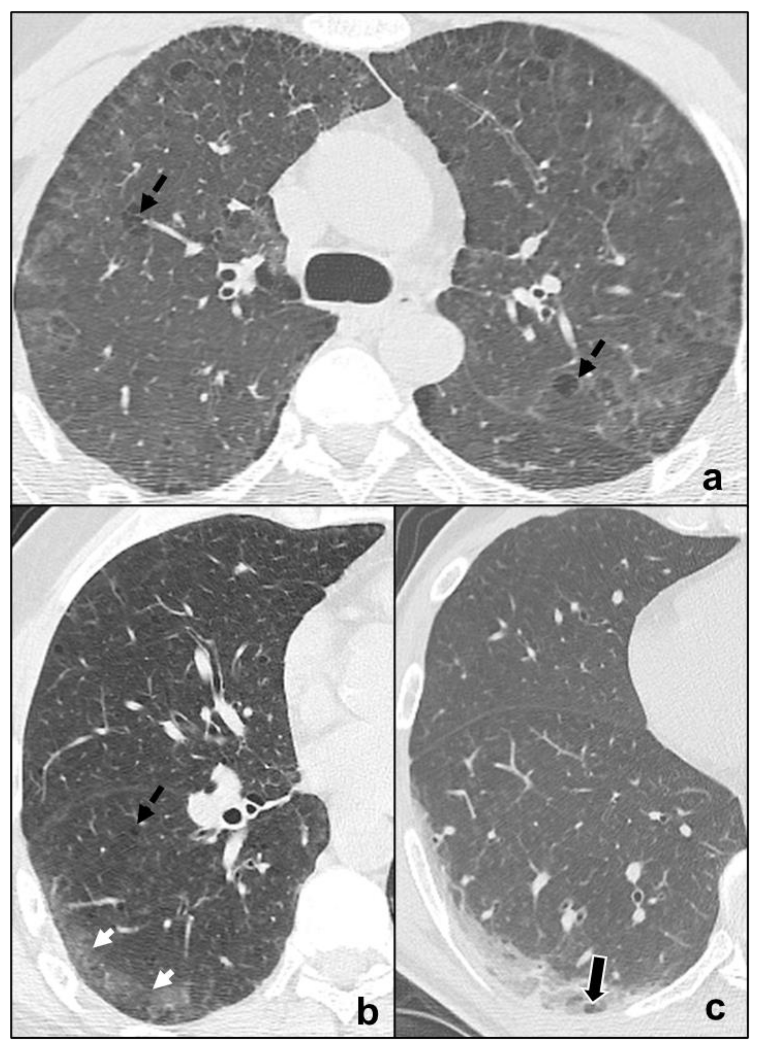 Tomography 07 00035 g004