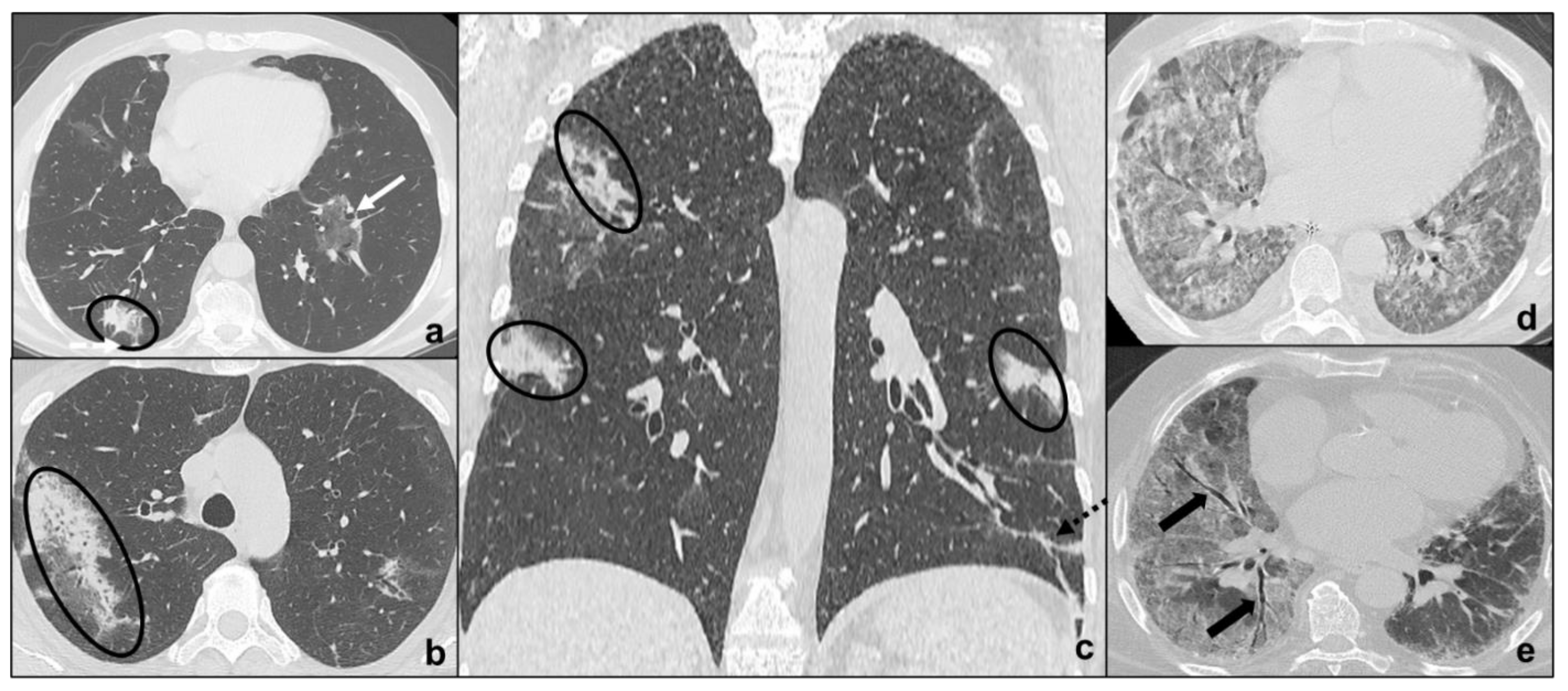 Tomography 07 00035 g005