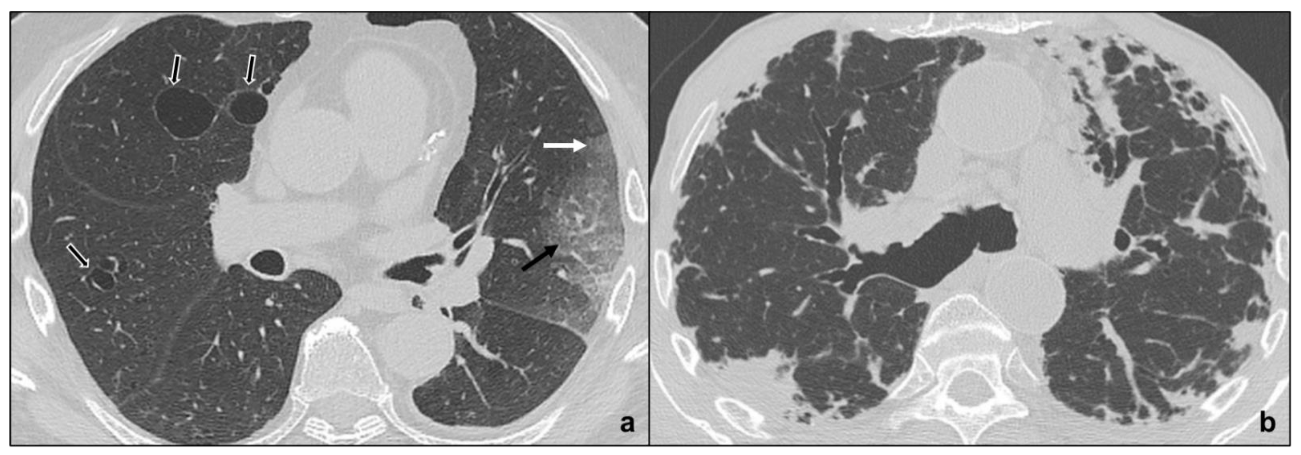 Tomography 07 00035 g006