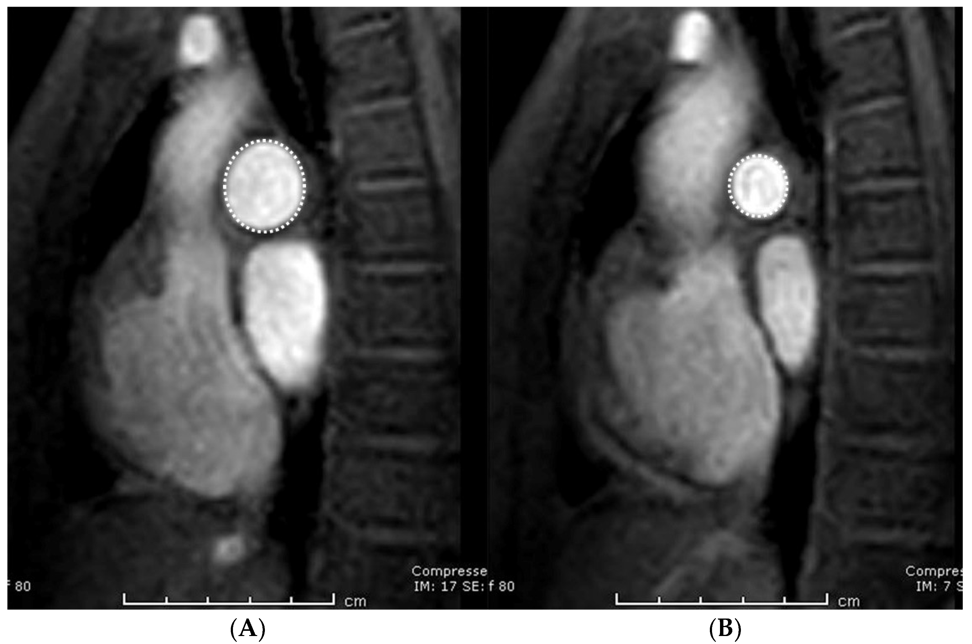 Tomography 07 00036 g003 Tomography 07 00036 g003