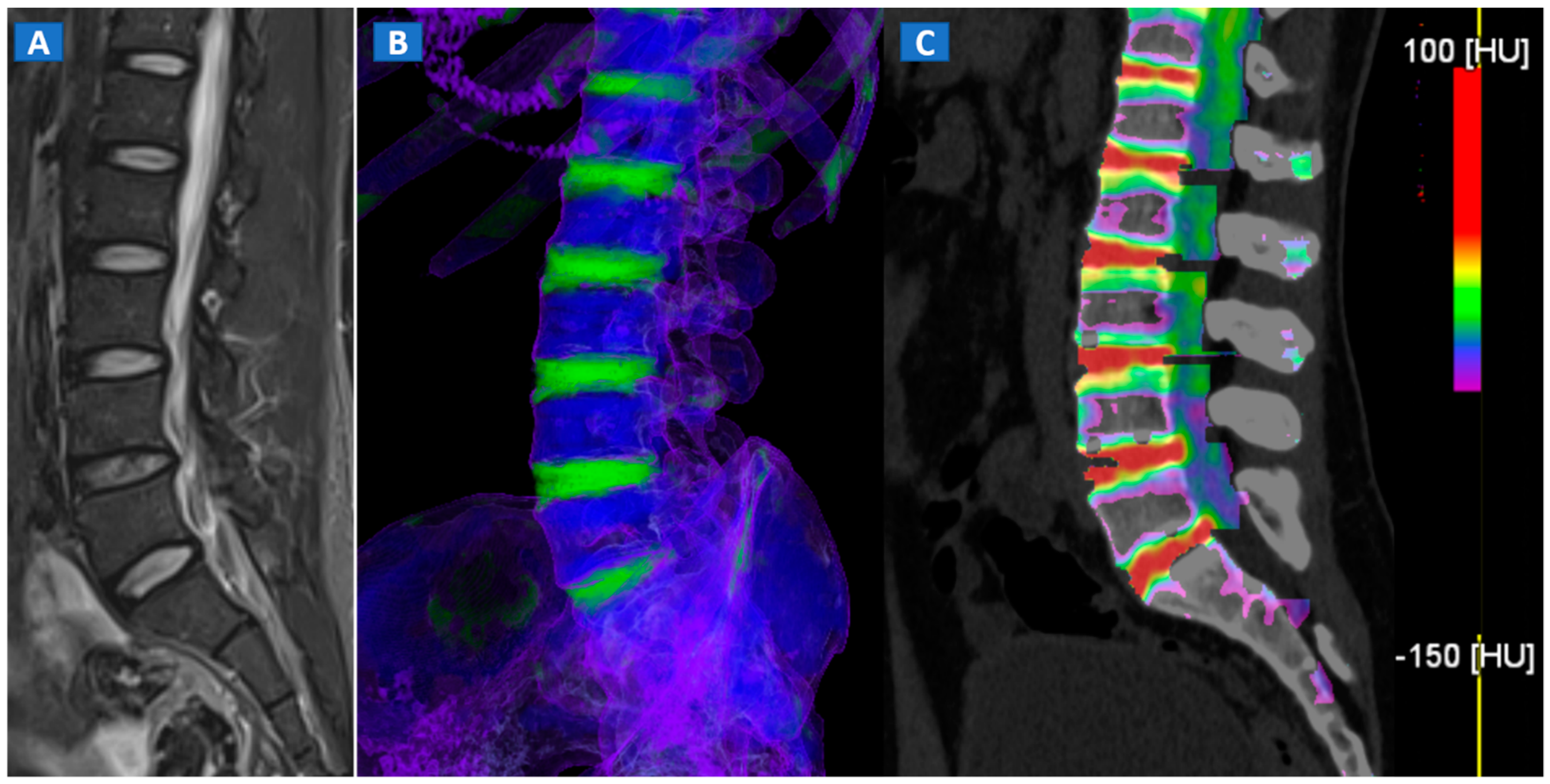Tomography 07 00037 g001