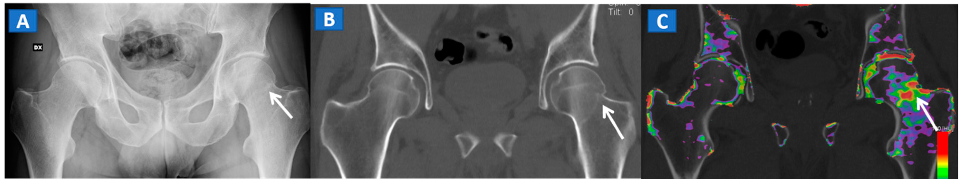 Tomography 07 00037 g003