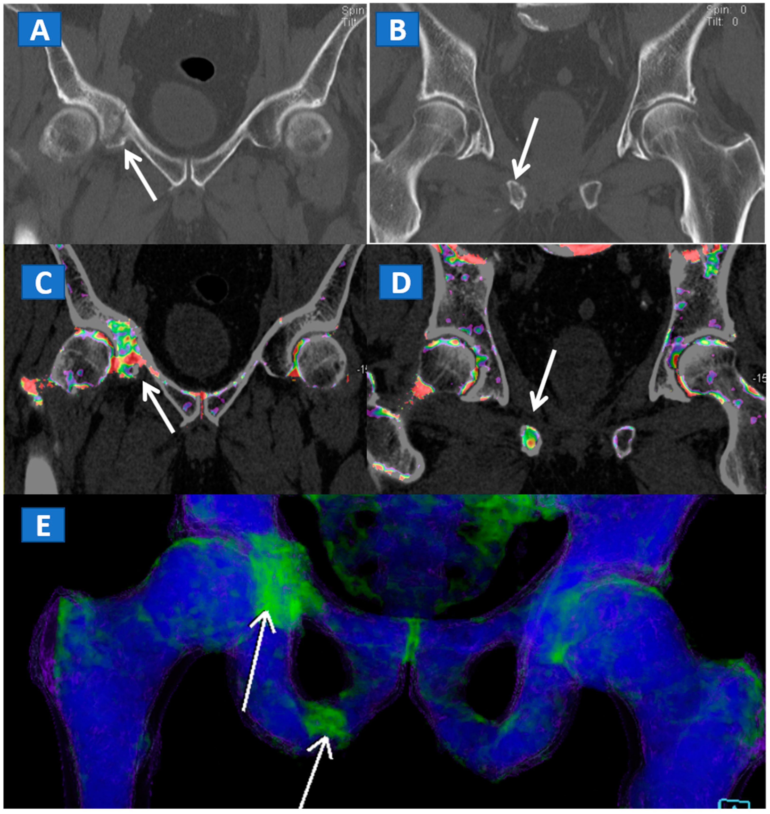 Tomography 07 00037 g004