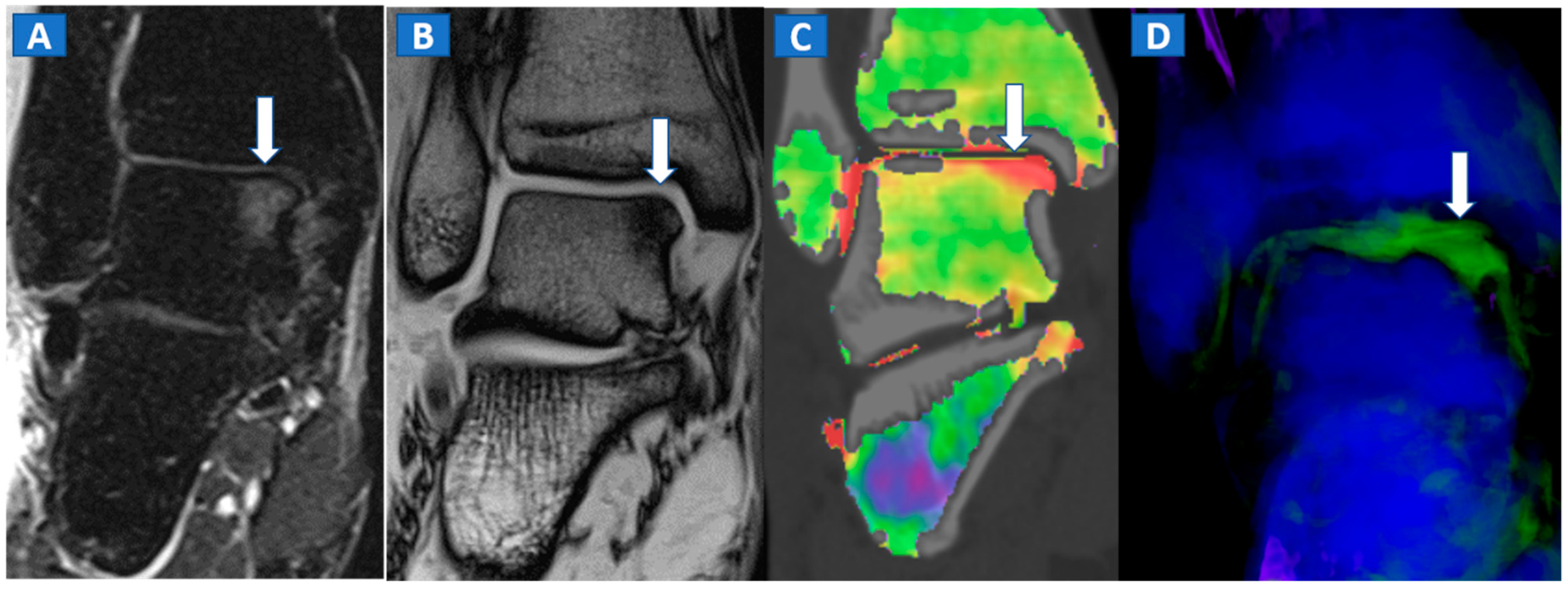 Tomography 07 00037 g007