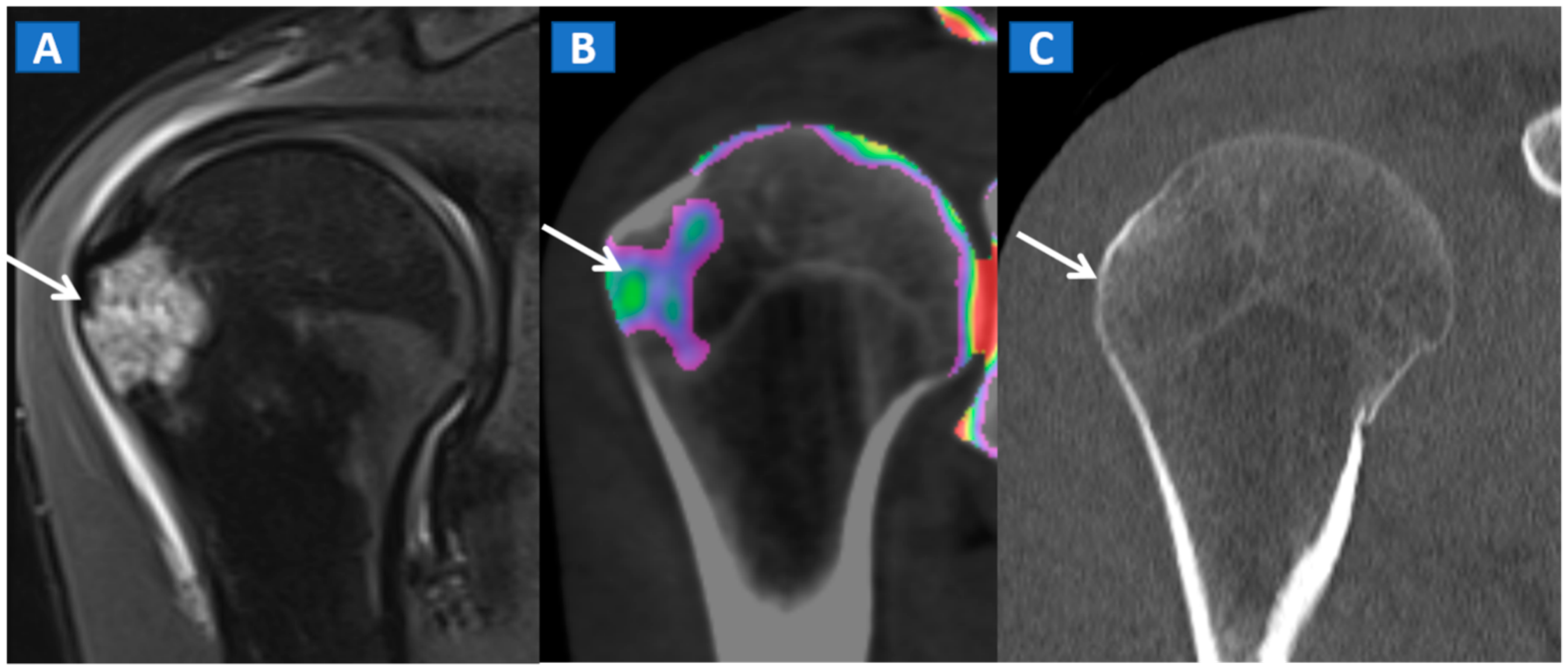 Tomography 07 00037 g008