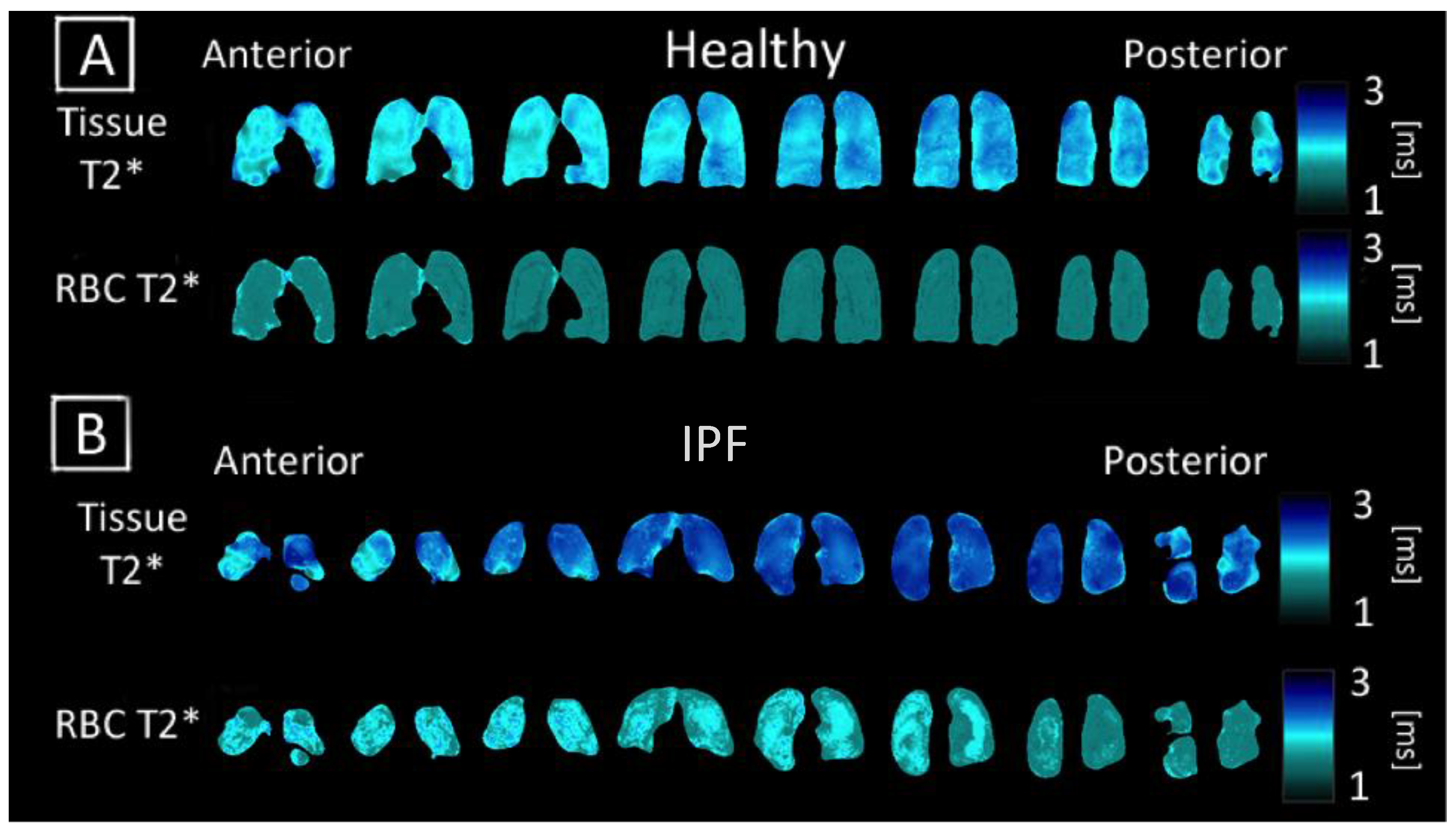 Tomography 07 00039 g004