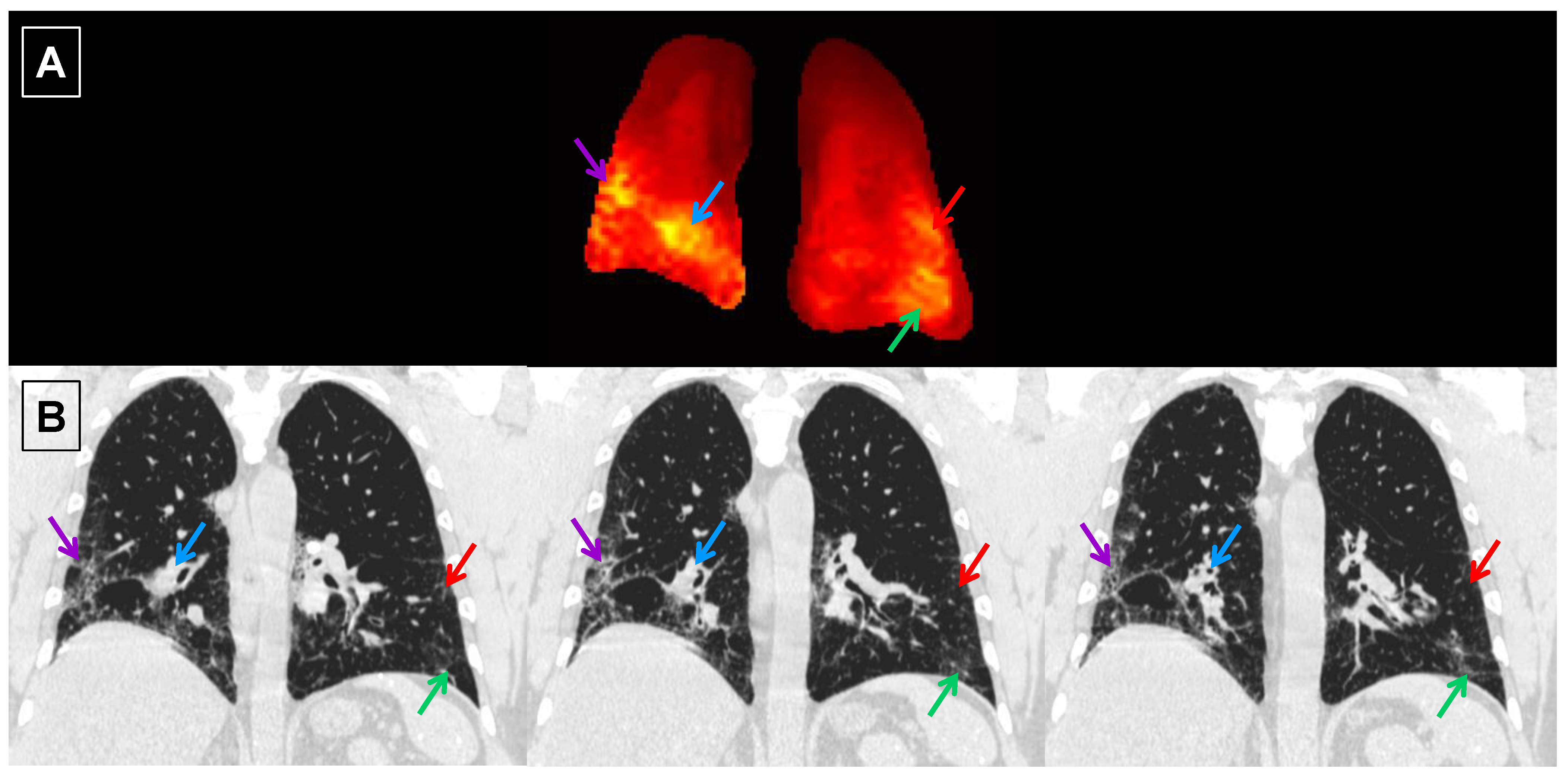 Tomography 07 00039 g008