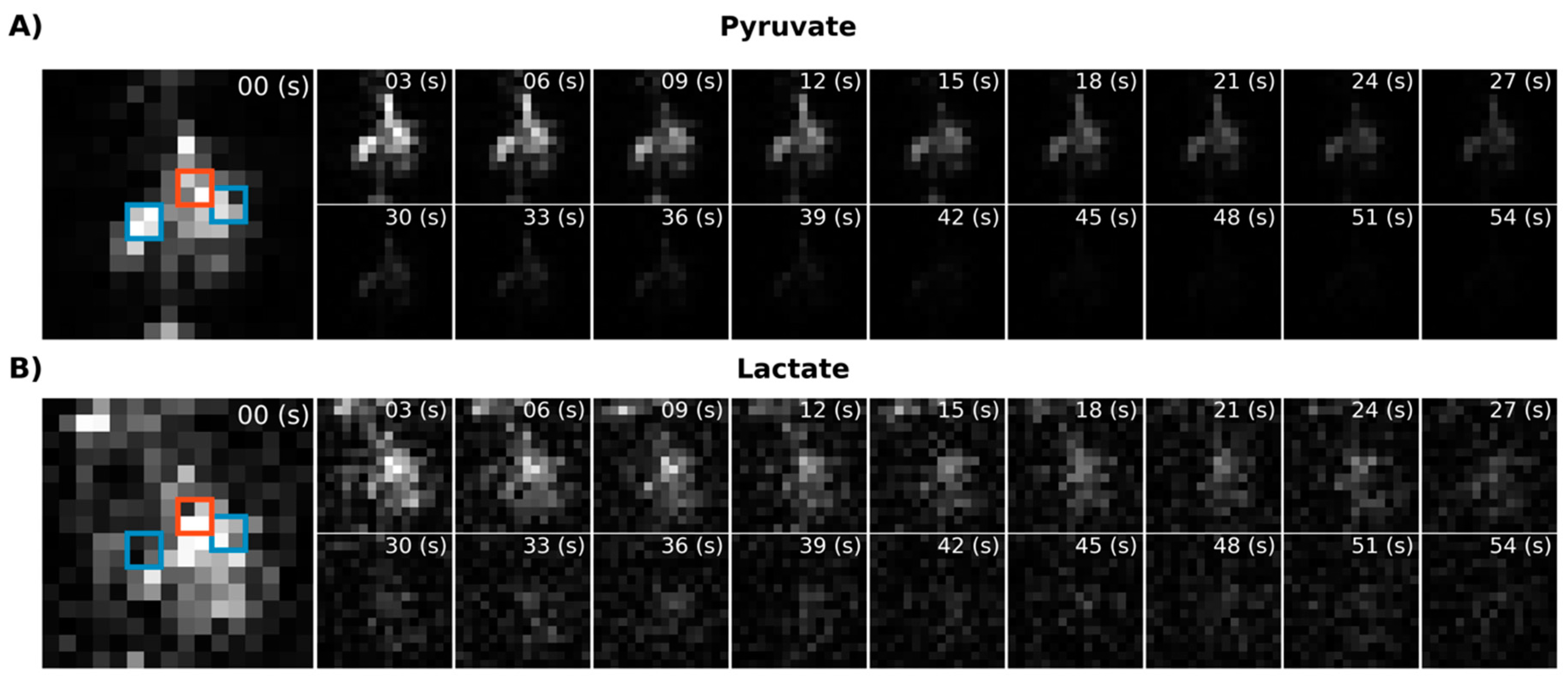 Tomography 07 00040 g005