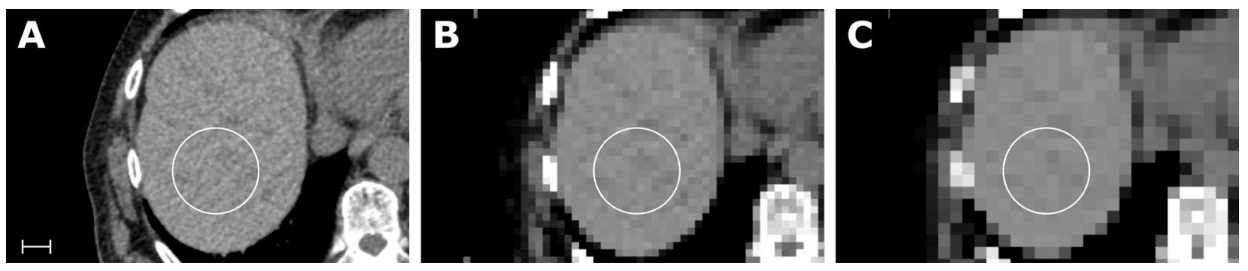 Tomography 07 00041 g003