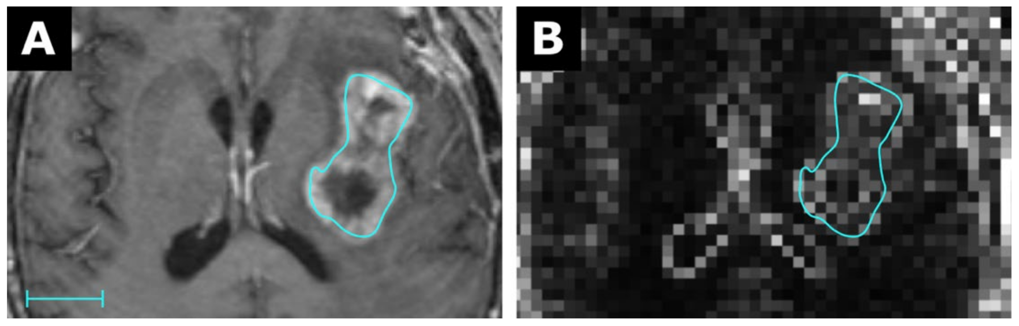Tomography 07 00041 g005