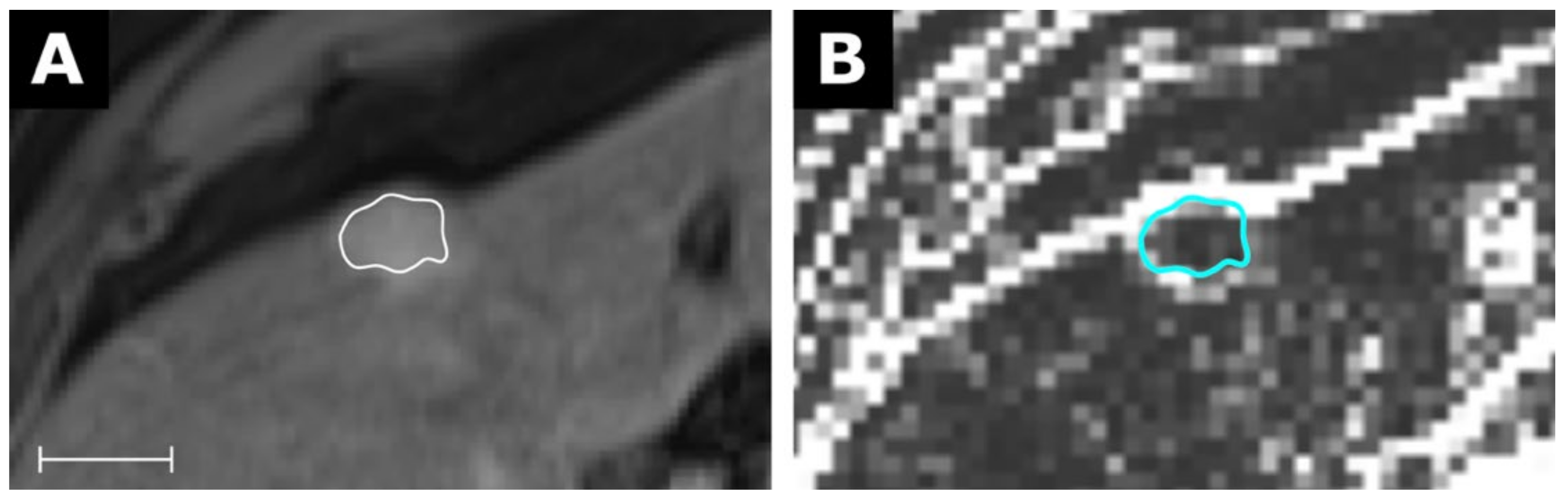 Tomography 07 00041 g006