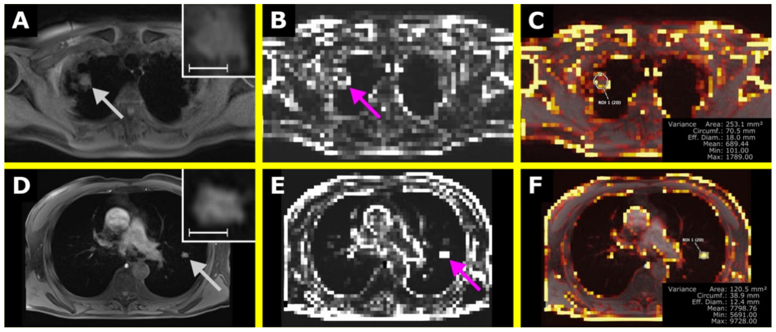Tomography 07 00041 g007